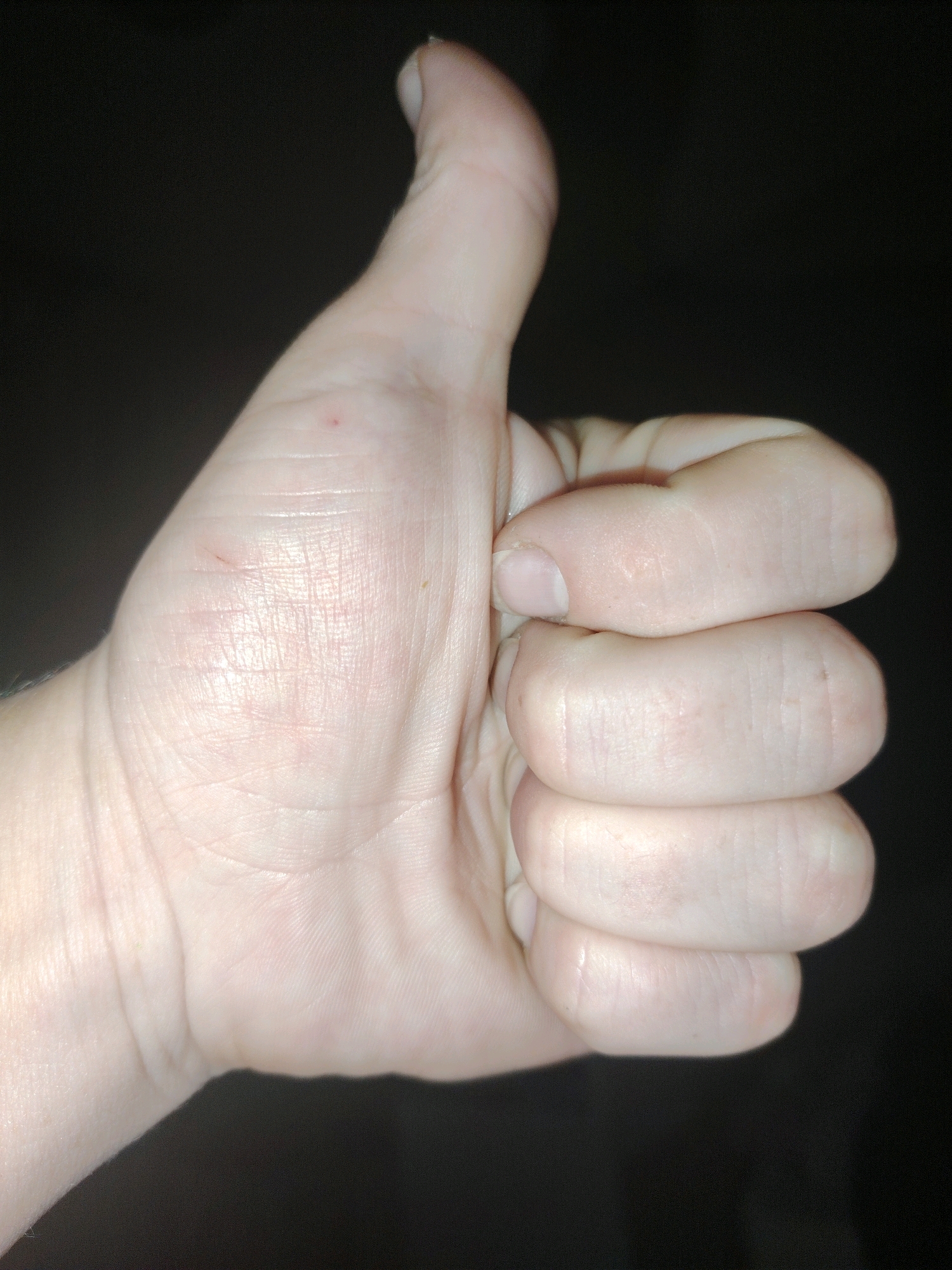 A close-up, top-down view shows a person's left hand in a thumbs-up gesture against a dark, out-of-focus background. The skin is fair, with visible lines on the palm. The fingernail of the thumb is visible at the top of the frame, and the other fingers are curled inwards and stacked, with the knuckles clearly defined. A small red mark, possibly a tiny scratch or blemish, is visible on the palm of the hand. There is no indication of the location in Dzyarzhynsk, Belarus.