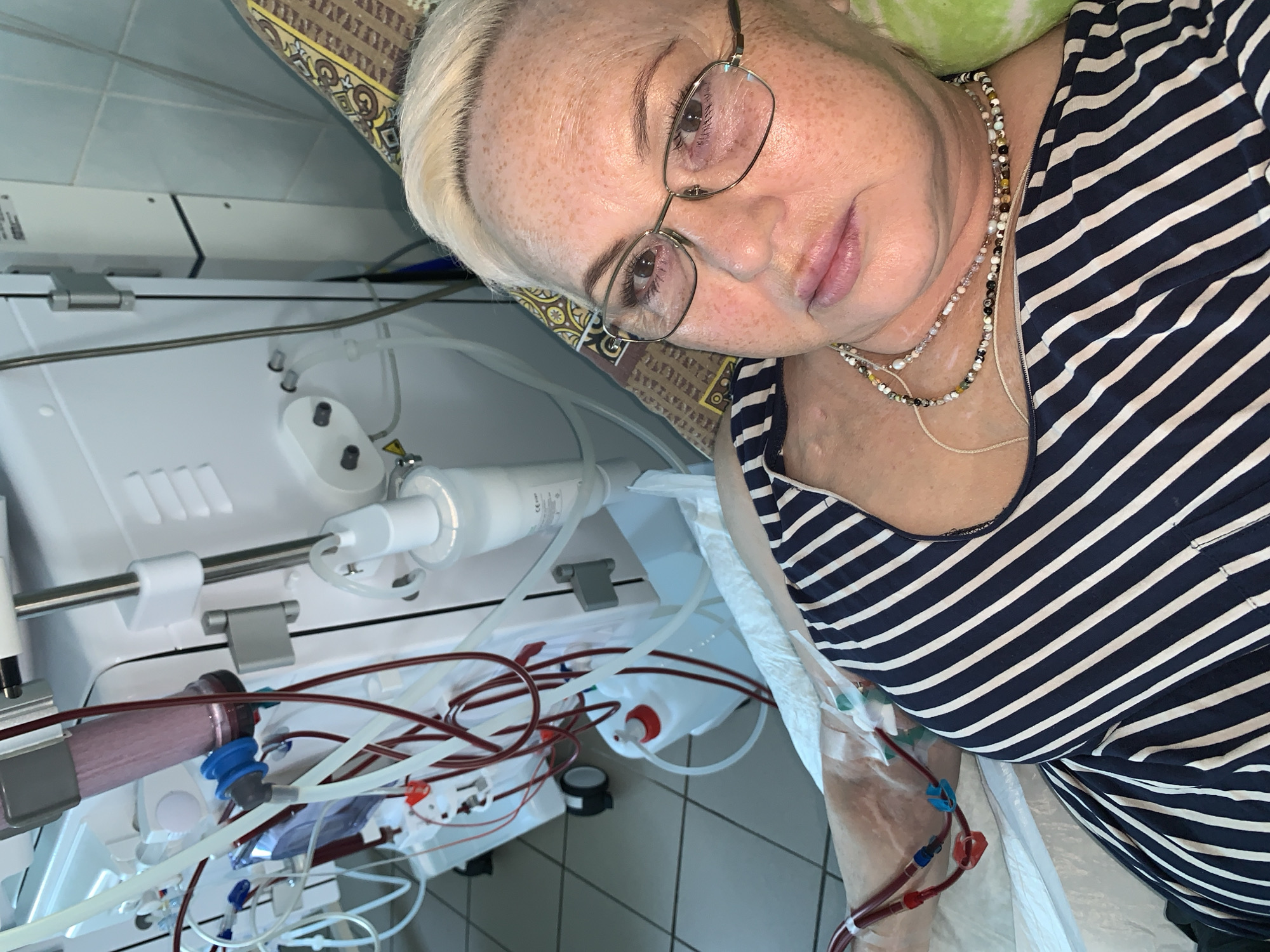 The image shows a woman lying on a patterned pillow and a hospital bed with a dialysis machine next to her. She is wearing glasses, a striped shirt, and several necklaces. Her arm is connected to the dialysis machine via tubes, indicating she is undergoing treatment. The background features a tiled floor and what appears to be medical equipment. There is no identifying location information about the city of Chaikovsky, Russia.