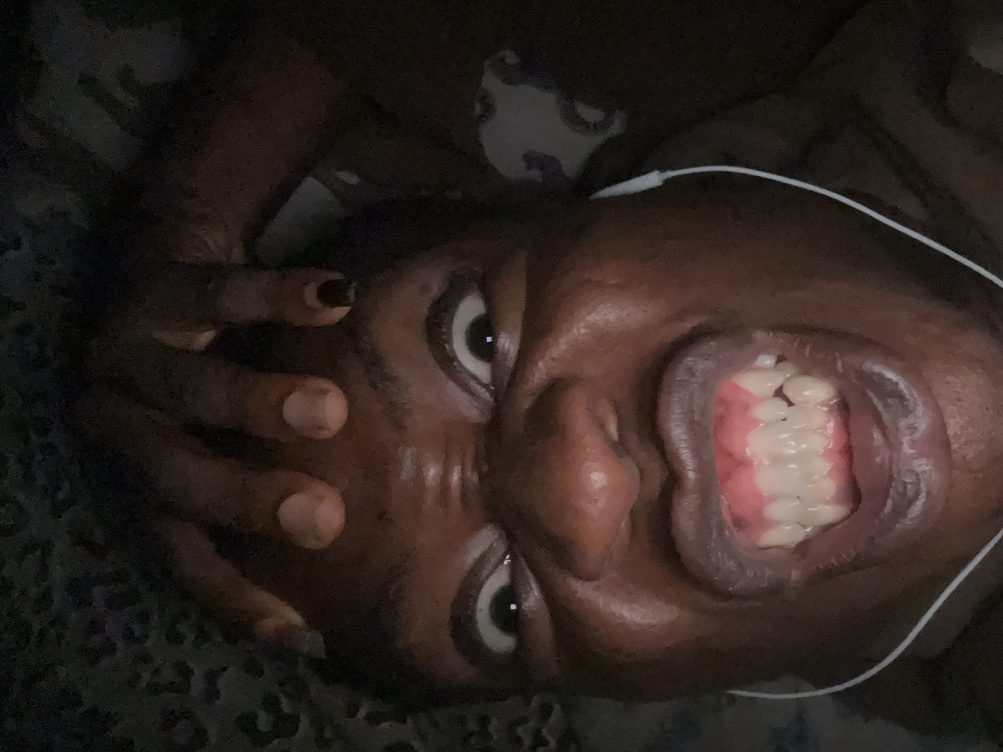A close-up, low-angle photograph depicts a person's face with wide-open eyes and mouth slightly ajar, revealing their teeth. The person has dark skin and a hand partially obscuring their forehead. A white earphone wire is visible near their ear. They are lying on patterned bedding. The location is not identified in the image.