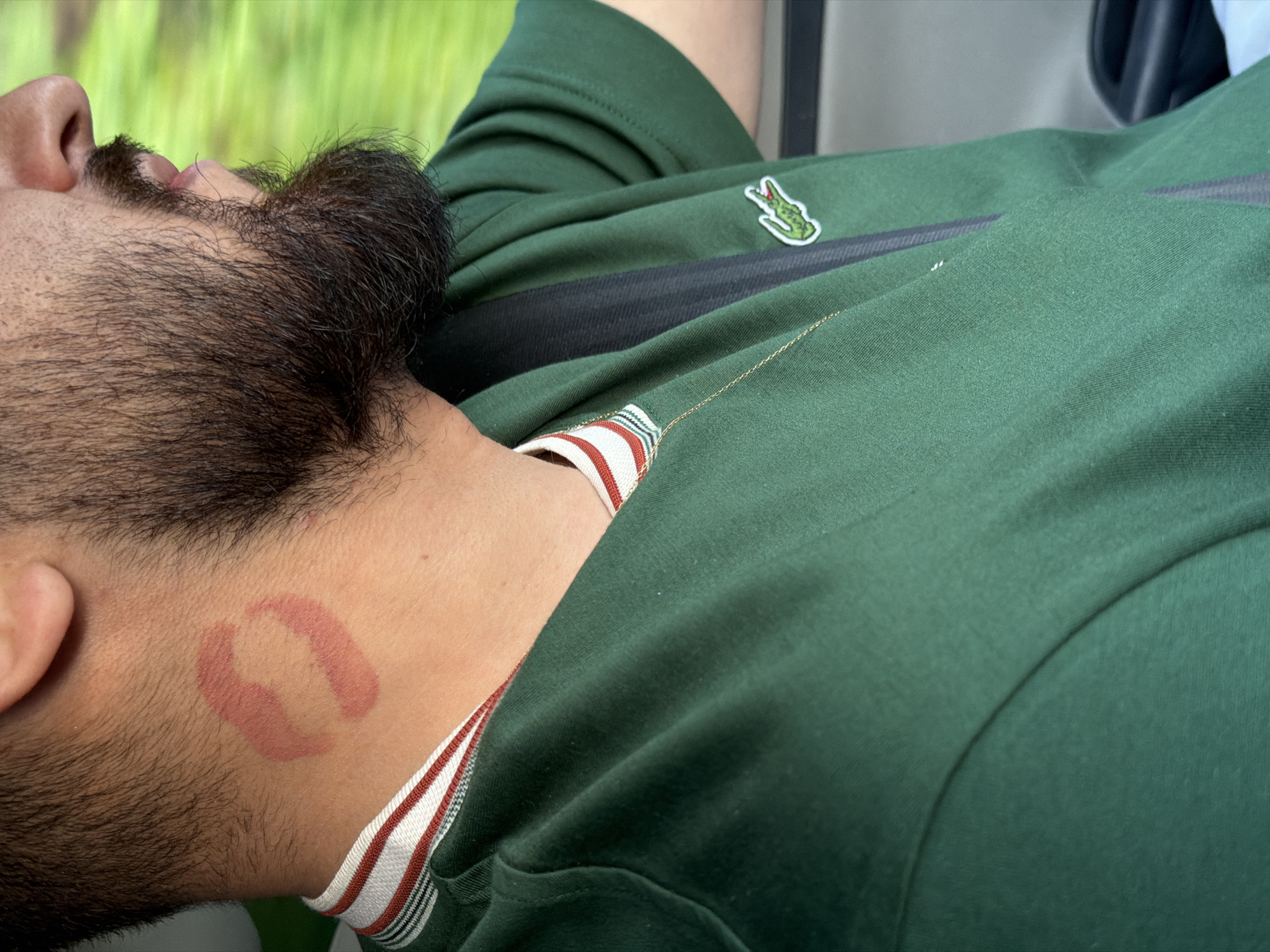 A man with a beard lies with his head turned to the side, displaying a lipstick mark on his neck. He is wearing a dark green Lacoste polo shirt with a striped collar. The location is unknown and not specified.