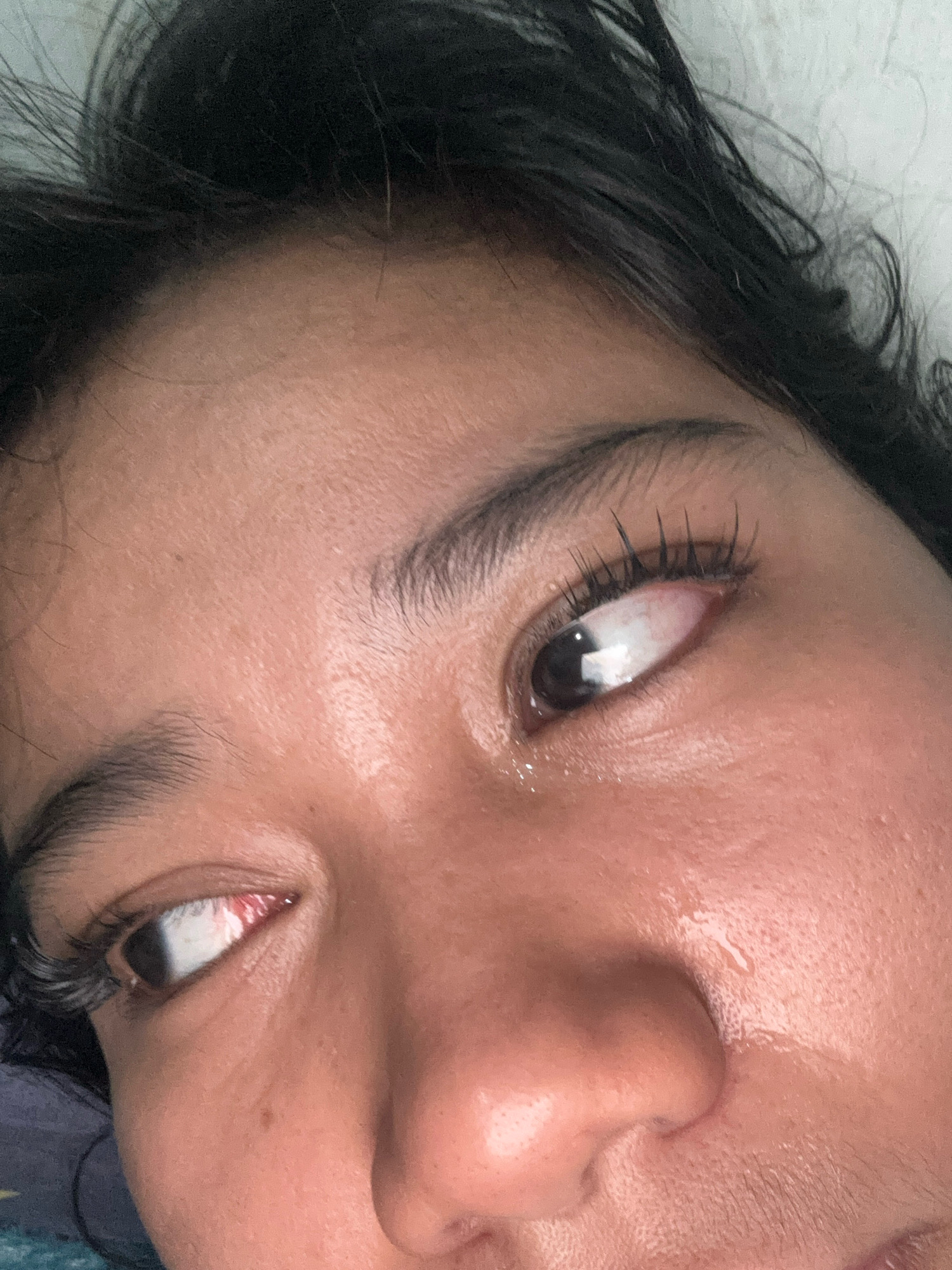 The image shows a close-up, low-angle view of a person's face, focusing on their eyes, nose, and forehead. The person has dark hair that partially obscures their forehead. Their eyes are open, and they appear to be looking to their left. There are visible tears on the person's cheek and under their right eye. The skin tone is light brown, and there are some minor imperfections visible on the skin. The background is a textured white surface, possibly a wall. There are no discernable elements in the image that would indicate a specific location in North Jakarta, Indonesia.