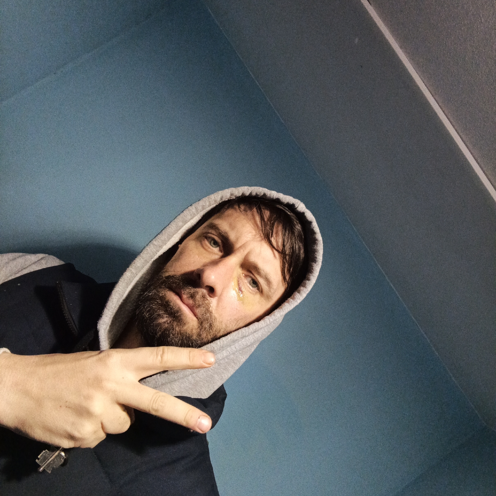 A bearded man in a gray hooded sweatshirt and a black jacket is angled upwards, giving a low-angle shot. He's making a peace sign with his left hand, and there is a shiny, possibly injured, area under his right eye. A set of keys hangs from his hand. The background is a blue wall with a sloped ceiling. No information indicates this image was taken in Mapkowski, Russia.