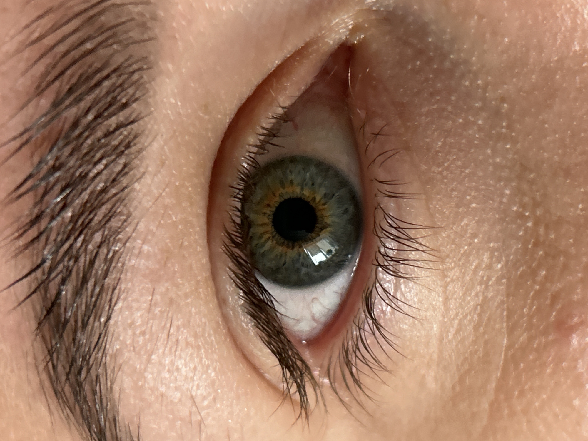 The image is a high-resolution, close-up photograph of a human eye. The central subject is the iris, which displays a complex coloration, primarily a blend of grey and blue with a distinct inner ring of golden-brown around the black, circular pupil. Clear, rectangular reflections of a light source are prominent on the surface of the iris and within the pupil.
The sclera, the white part of the eye, shows several fine red blood vessels, particularly visible towards the lower portion. Long, dark eyelashes frame the eye, appearing thick and well-defined, especially along the lower lid. To the left, a section of a dark, dense eyebrow is visible, contrasted against light-toned skin. The surrounding skin reveals fine texture, pores, and some very fine hairs, suggesting a natural and unedited appearance.
The lighting appears bright and direct, contributing to the sharp reflections in the eye. No specific activity or event is captured beyond the eye being open. There are no discernible location cues, weather conditions, or visible text within the image itself. The close perspective highlights intricate anatomical details of the eye and surrounding facial features, providing an intimate view of the subject.
