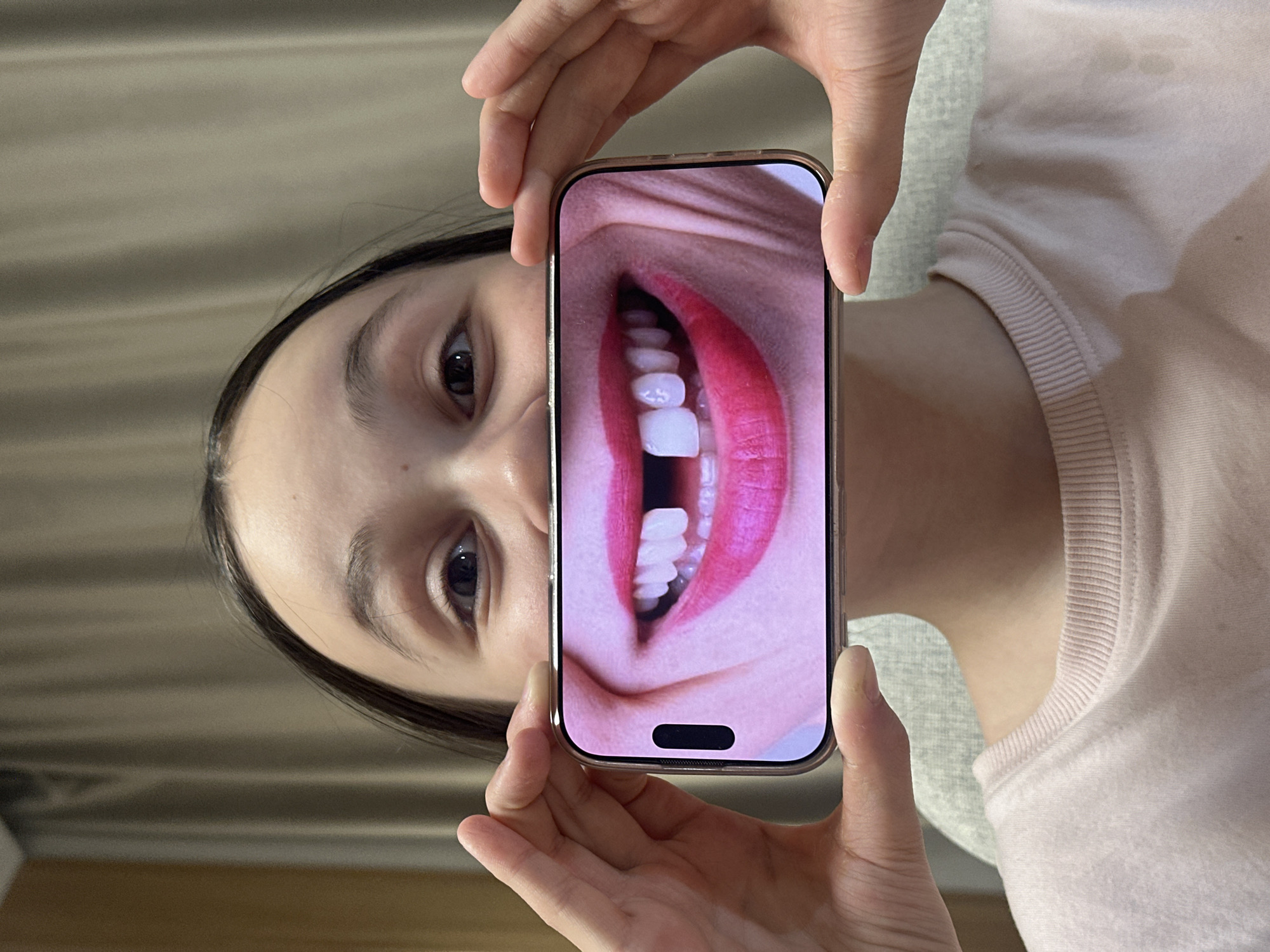 An indoor portrait-oriented image captures a young person holding a gold-colored smartphone in front of their face. The subject's head is slightly tilted, allowing parts of their face, including their forehead, eyes, and nose bridge, to be seen around the edges of the device. Dark hair is visible framing the face. The person is wearing a light pink long-sleeved top with a ribbed crew neck, visible on the right side of the frame. Their hands hold the phone firmly at the top and bottom.
The smartphone's screen displays a vibrant close-up image of an open mouth. This image features bright red lipstick on full lips and a row of stark white teeth. A prominent detail within the screen's image is a noticeable gap in the upper front teeth, suggesting a missing tooth. The bottom of the phone's display also shows a dark, pill-shaped cutout, characteristic of a modern smartphone's dynamic island.
The person's visible left eye gazes directly towards the viewer with a neutral and somewhat curious expression. The background is a plain, light-colored wall or curtain, presenting a simple indoor setting. The photograph appears to capture a moment of playful interaction with the smartphone, possibly creating an optical illusion or humorous effect by juxtaposing the real face with the displayed image. This scene takes place in Votkinsk, Russia. No readable text is visible in the image.