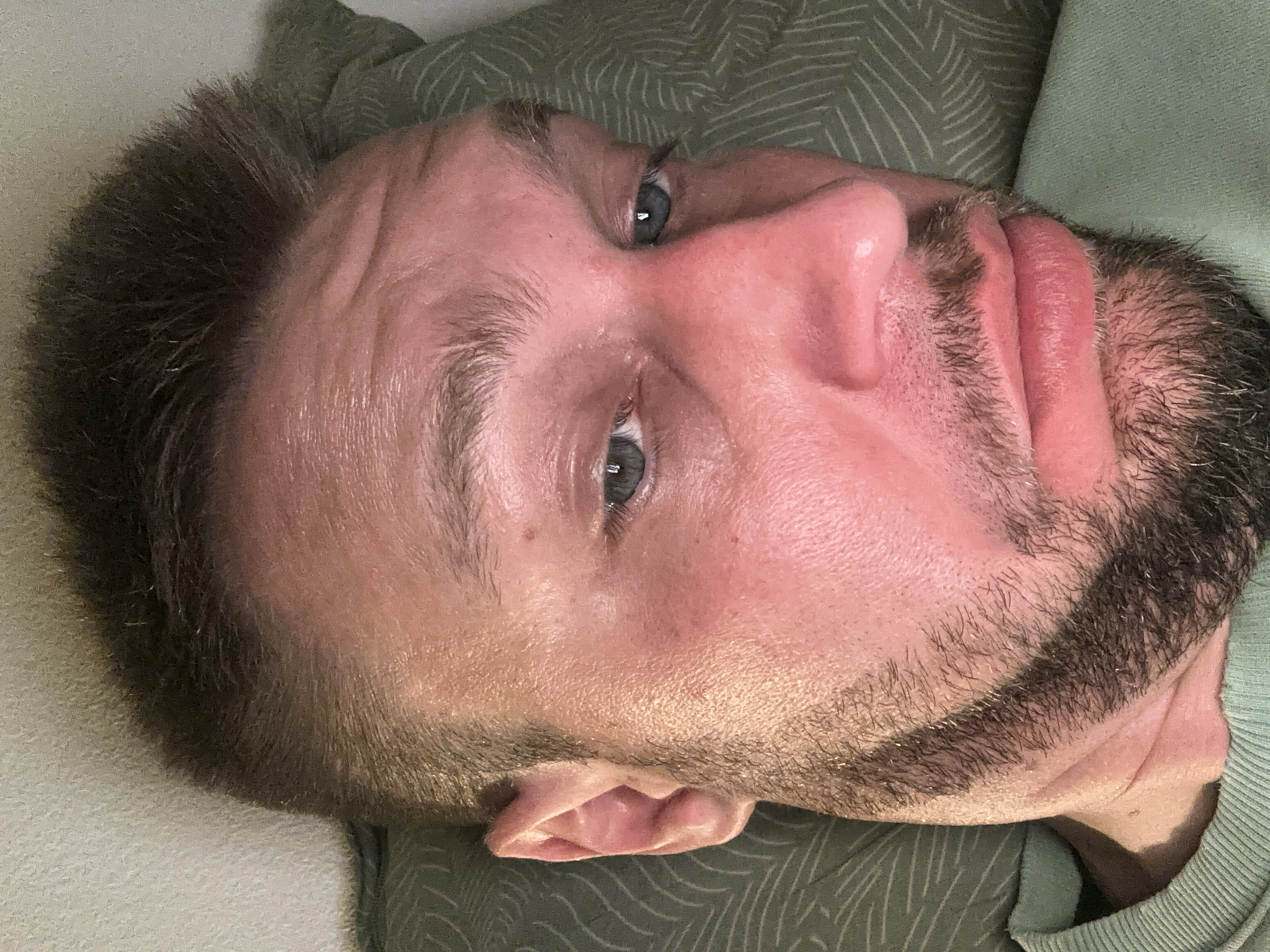 A close-up, overhead, selfie-style shot shows a person with fair skin, reddish cheeks, and dark brown hair with some gray streaks. The person has a neatly trimmed beard and mustache, with short hair on the sides of their head and longer hair on top. Their eyes are open and looking slightly off-camera. The person is lying on a green patterned pillow, and wearing a light green sweatshirt. The background is a textured light-colored wall. The scene is indoors. The image is taken from the neck up.