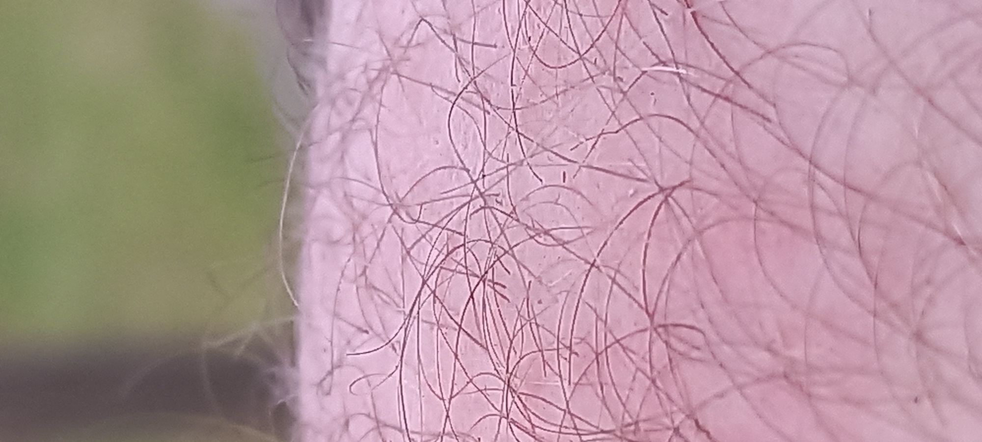 The image provides a close-up, macro perspective of human skin, displaying a light pinkish-red coloration. Numerous short, fine, dark hairs are densely distributed across the skin surface, with many exhibiting a slight curl or random orientation. The background is significantly out of focus, appearing as a blurred field of green, consistent with natural foliage or grass. A darker, indistinct vertical mass is visible towards the left edge of the blurred background. No specific individuals, actions, or identifiable landmarks are present in the frame.