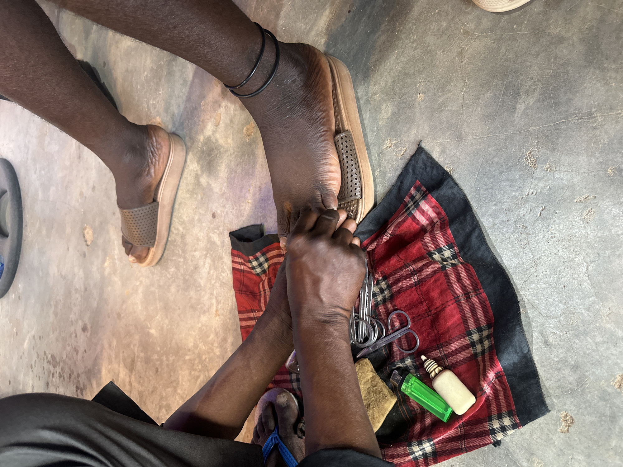 An overhead shot captures a scene where a person is receiving a pedicure outdoors, likely in Jos, Nigeria. A dark-skinned individual sits with their right foot resting in a tan sandal, while another person manipulates the toes with their hands. A plaid cloth lies beneath the hands, holding a pair of scissors, a lighter, a small bottle, and a sponge. The environment is simple, with a concrete floor serving as the background. A dark-skinned individual is also wearing sandals on their left foot. A dark ankle bracelet is visible.
