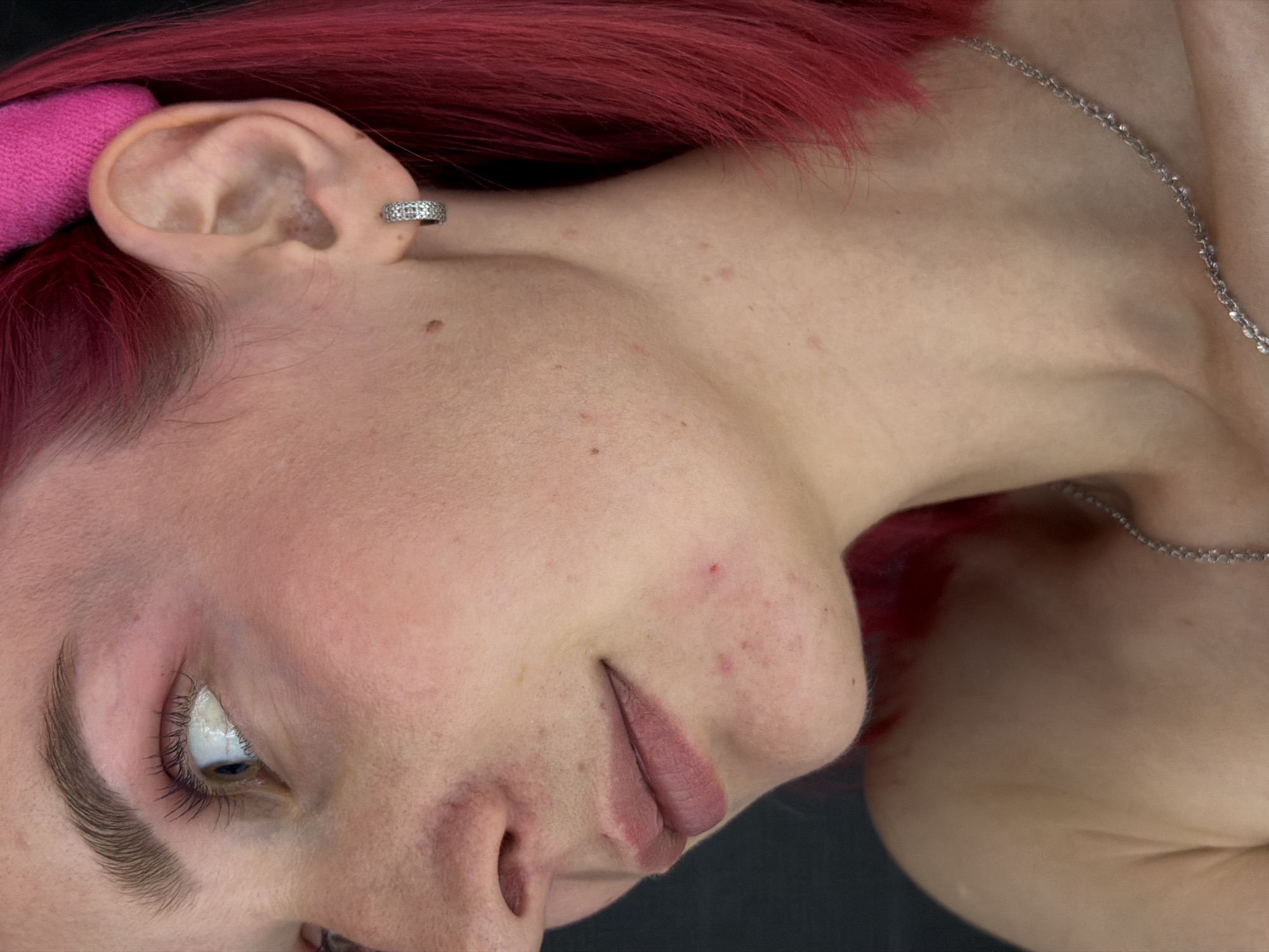 The image is a close-up portrait of a young woman with bright pink hair, wearing a silver hoop earring with small stones and a silver chain necklace. She is looking to her left, with her face angled away from the camera. The background is dark and out of focus. There are no specific landmarks or indications of Chaikovsky, Russia in the image. The woman has some acne on her chin and neck, and her skin appears to be slightly flushed. Her eyebrows are dark and well-defined, and her eyelashes are long. The lighting is soft, highlighting the contours of her face.
