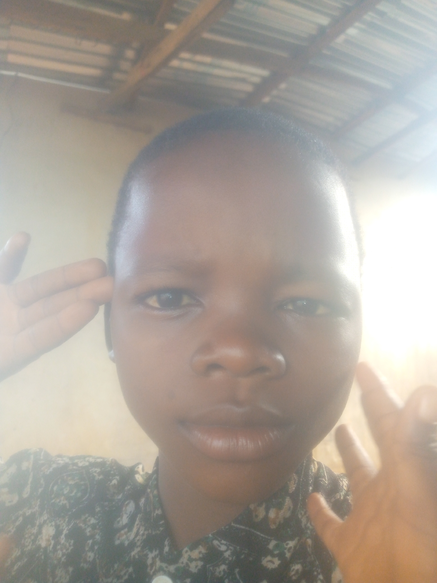 A close-up, brightly lit portrait features a young person, likely a child or young adult, with dark skin and short, dark hair, looking directly at the camera. The subject's face is heavily illuminated by a strong light source from the upper right, causing significant overexposure and glare, particularly on the right side of their face.
Both hands are raised to the sides of their head, with fingers touching near the temples or ears. The left hand shows individual fingers, while the right hand's fingers are less distinct due to the intense light. The subject is wearing a dark garment with a light-colored, abstract pattern, visible across their chest and shoulders.
The background reveals an indoor or covered setting. Behind the subject, a plain, light-colored wall is visible. Above, a ceiling structure with visible dark wooden beams and a lighter, possibly corrugated, roofing material can be discerned. The intense lighting suggests the photograph was taken during the daytime. The subject maintains a neutral expression. No visible text is present in the image.
