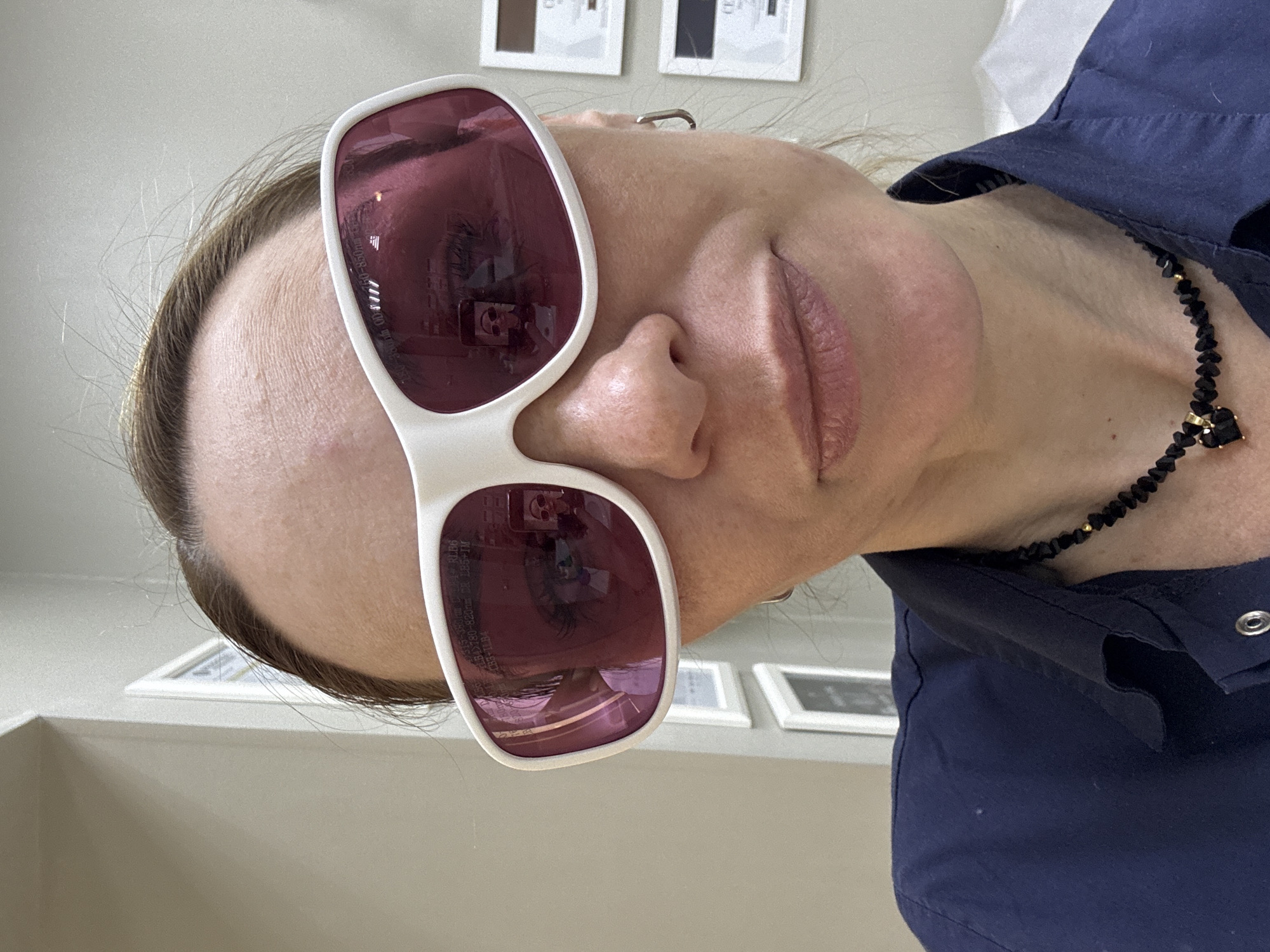 A woman is depicted in a close-up, angled shot, appearing to be lying down or with the camera held sideways. She has light skin, brown hair pulled back, and her lips are softly colored with lipstick, maintaining a neutral expression.
She is wearing large, white-framed protective eyewear with dark red/purple tinted lenses, likely used for laser or light-based cosmetic treatments. Visible reflections in the lenses include a smartphone being used to take the selfie, and parts of an eye and other facial features. Faint white text on the glasses' lens indicates laser safety specifications, such as "RLB6," "CE," "95-550nm OD 6," and "DD=700-850nm," identifying them as protective gear.
The woman is dressed in a dark blue shirt, possibly a uniform or scrub top, with metal snaps visible on the placket. She also wears a black beaded necklace adorned with a small gold-colored bead and a black charm.
The background features a light-colored wall with two small, framed pictures and a light-colored shelf or counter. The setting, potentially in Russia, appears to be an indoor professional environment, such as a clinic or spa, where procedures requiring eye protection are performed. The time of day is not apparent.