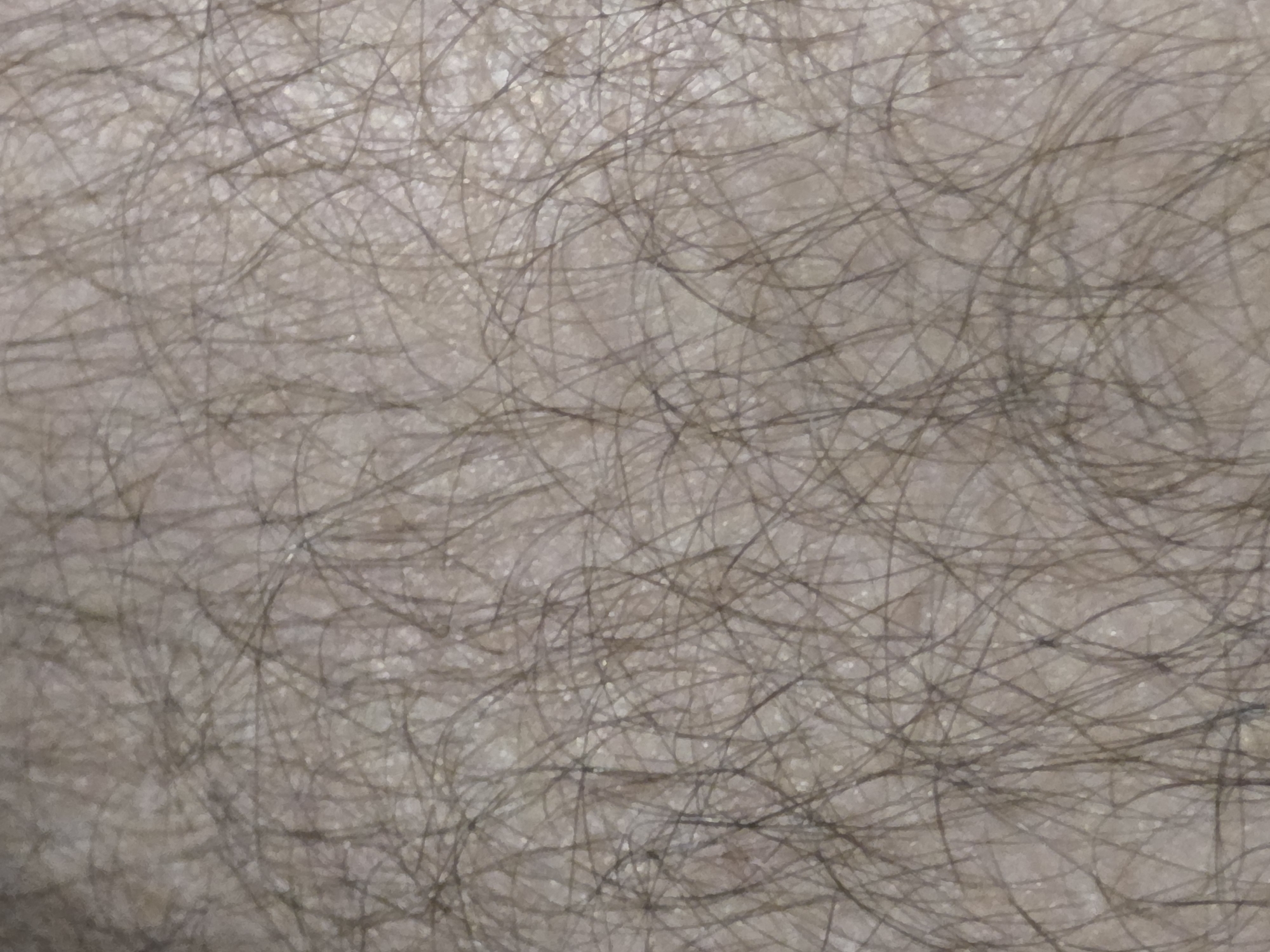 The image is a close-up, macro photograph of human skin covered with dark hair. The skin appears light-toned with visible pores and texture. The hairs are short and thinly distributed, with varying directions and curvatures. The lighting creates subtle shadows, highlighting the texture of the skin and the individual hairs. The background is an undifferentiated mass of skin and hair. There are no other objects or environmental features visible in the frame. The location is not discernible from the image.