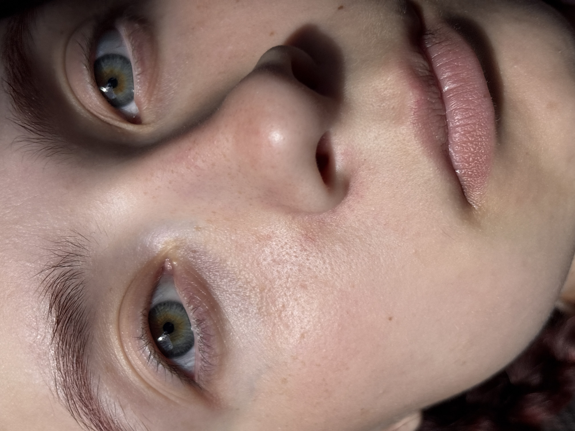 A close-up photograph shows a person's face angled upwards. The face features two eyes, a nose, and lips. The eyes have a light-colored iris, possibly grey or hazel. The skin appears smooth with some visible pores and minor blemishes. The lighting casts shadows across the nose and upper lip. There are no indications of the location being Alnashi, Russia.