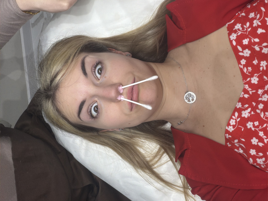 This scene takes place within an indoor facility in Budva, Montenegro, likely a beauty salon or spa. A blonde female, estimated to be in her 20s or 30s, is positioned supine on a white treatment bed, looking directly at the camera with a wide-eyed, expressive facial gesture. She is attired in a red garment with a white floral pattern, overlaid by a solid red outer layer, and wears a silver-toned necklace featuring a circular "Tree of Life" pendant. Two cotton-tipped applicators, distinguished by pink, bulbous ends, are visibly inserted into her nostrils, extending downwards. A partial view of a second individual's arm, wearing a light brown sleeve and a gold bracelet, is present in the upper right, indicative of proximity or an ongoing procedure with the primary subject.