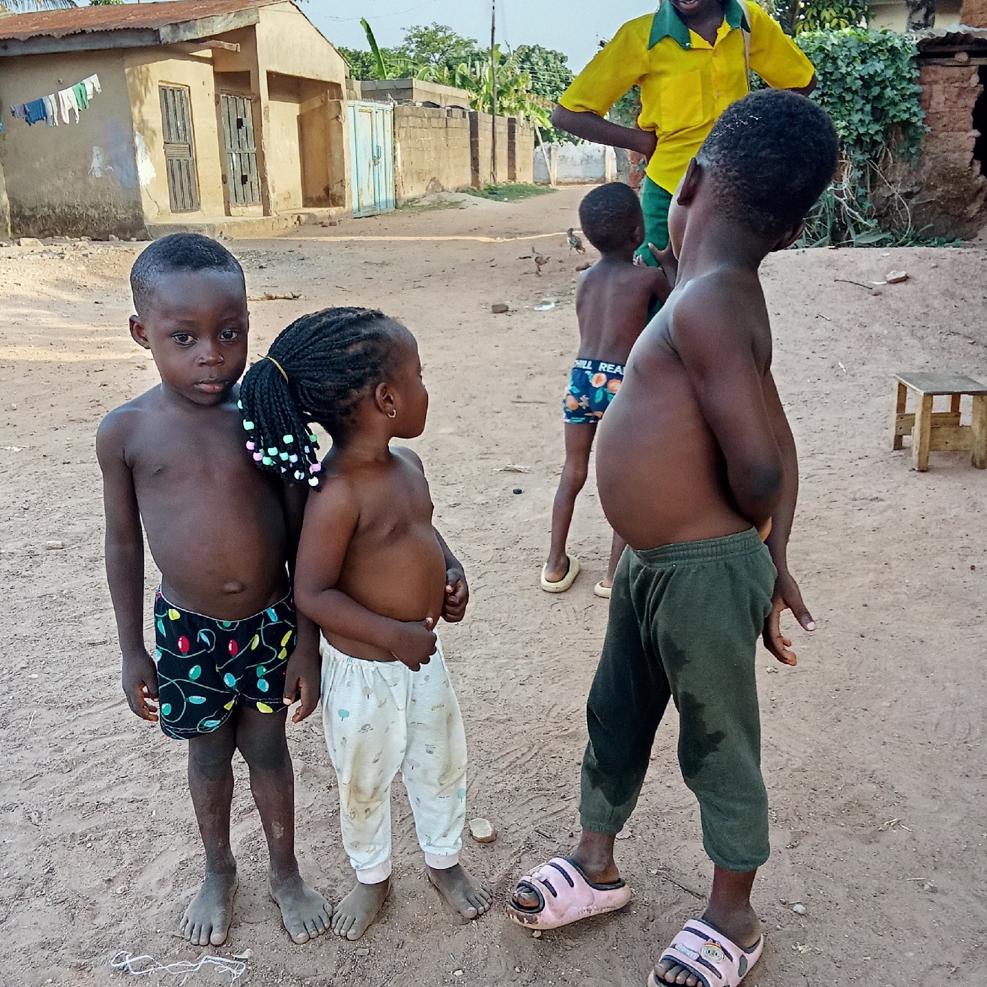 This candid photograph captures a group of five individuals, primarily children, in a dusty, unpaved street setting in Akwanga, Nigeria.
In the foreground, a young, shirtless boy stands on the left, looking directly at the camera with a neutral expression. He wears dark shorts with colorful patterns and has bare, dusty feet. Beside him, a young, shirtless girl with braided hair, adorned with colorful beads in a ponytail and small hoop earrings, looks towards the right. She wears light-colored patterned pants and also has bare, dusty feet. To their right, a slightly older, shirtless boy stands with his back mostly to the camera, wearing dark green or gray track pants and pink slide sandals. His midsection appears somewhat distended.
Further in the mid-ground, partially obscured by the boy in the foreground right, another young, shirtless boy wears blue patterned boxer shorts with the visible text "ALL REA" and light-colored slides. In the background, a taller individual, likely an adult, is seen from the waist up, wearing a bright yellow shirt with a green collar and green pants, facing away from the camera.
The setting depicts a residential area with rustic buildings; notably, a light-brown structure with a corrugated metal roof and wooden windows/doors is visible in the background on the left. Laundry hangs on a line near this building. A blue metal gate is also present. The ground is dry and dusty, characteristic of an unpaved road or common area. Two chickens are visible pecking at the ground in the mid-distance. Lush green trees and foliage line the background, indicating an outdoor, possibly rural or semi-urban environment under bright daylight. The children appear to be casually gathered, perhaps playing or simply observing their surroundings.
