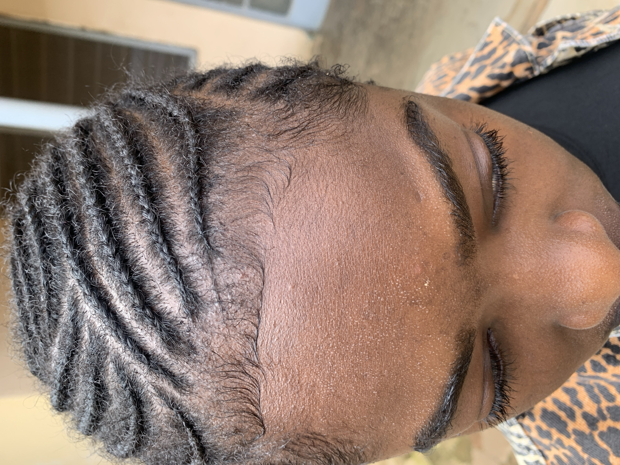 The image captures an individual from an elevated perspective, focusing on their head and upper torso, located in Rafin Par, Nigeria. The subject has a dark brown skin tone. Their hair is styled in multiple parallel cornrows, which are tight braids running from the forehead towards the back of the head. Loose, short hairs are visible between the braided sections. Fine white particulates are present on the scalp and throughout the hair. The hairline features short, wavy baby hairs. The forehead and other visible skin areas display numerous small, raised bumps and texture. A singular, light-colored, irregular speck is visible on the upper right side of the forehead. Both eyes are closed or angled downwards, revealing dark, well-defined eyebrows and prominent eyelashes. The individual is wearing a garment with a distinct leopard print pattern in brown, black, and tan, over a plain black inner layer. The background is out of focus, suggesting an outdoor setting with a light-colored building structure partially visible.