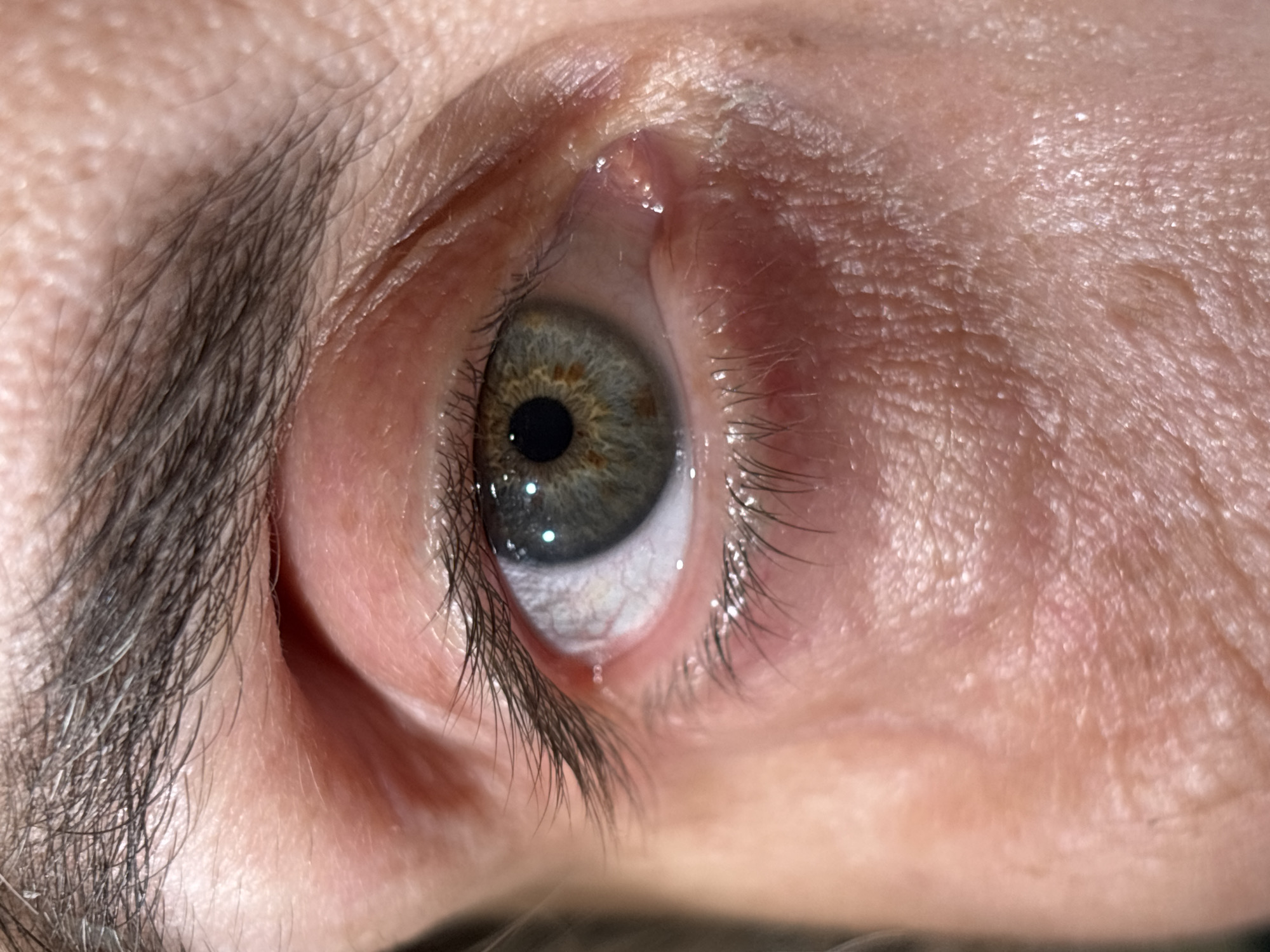 The image shows a close-up view of a human eye, with a gray-green iris and a black pupil. The surrounding skin is fair, with visible wrinkles and fine lines. Dark brown eyelashes are present on both the upper and lower eyelids, and a dark brown eyebrow is visible above the eye. There is no indication of the city of Tbilisi, Georgia, or any specific location. The image focuses solely on the eye and surrounding facial features.