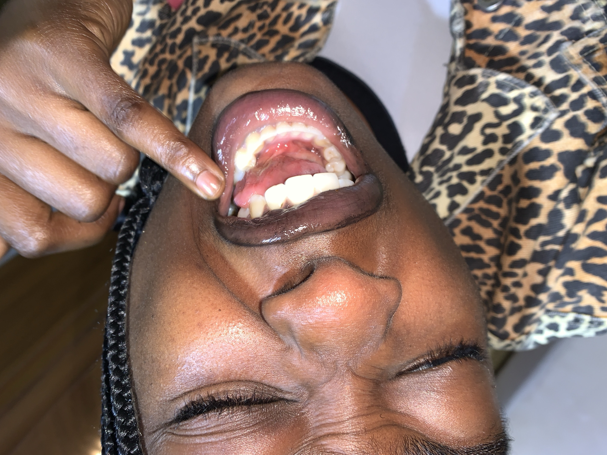 A close-up, overhead shot shows a person's mouth and face, with their mouth open and a finger pointing inside. The person has dark skin and braids. They are wearing a leopard-print shirt. The image is cropped tightly on the subject's face and does not provide any information about the location in the city of Gura Top, Nigeria. The scene appears to be indoors, but no specific details about the environment are visible.