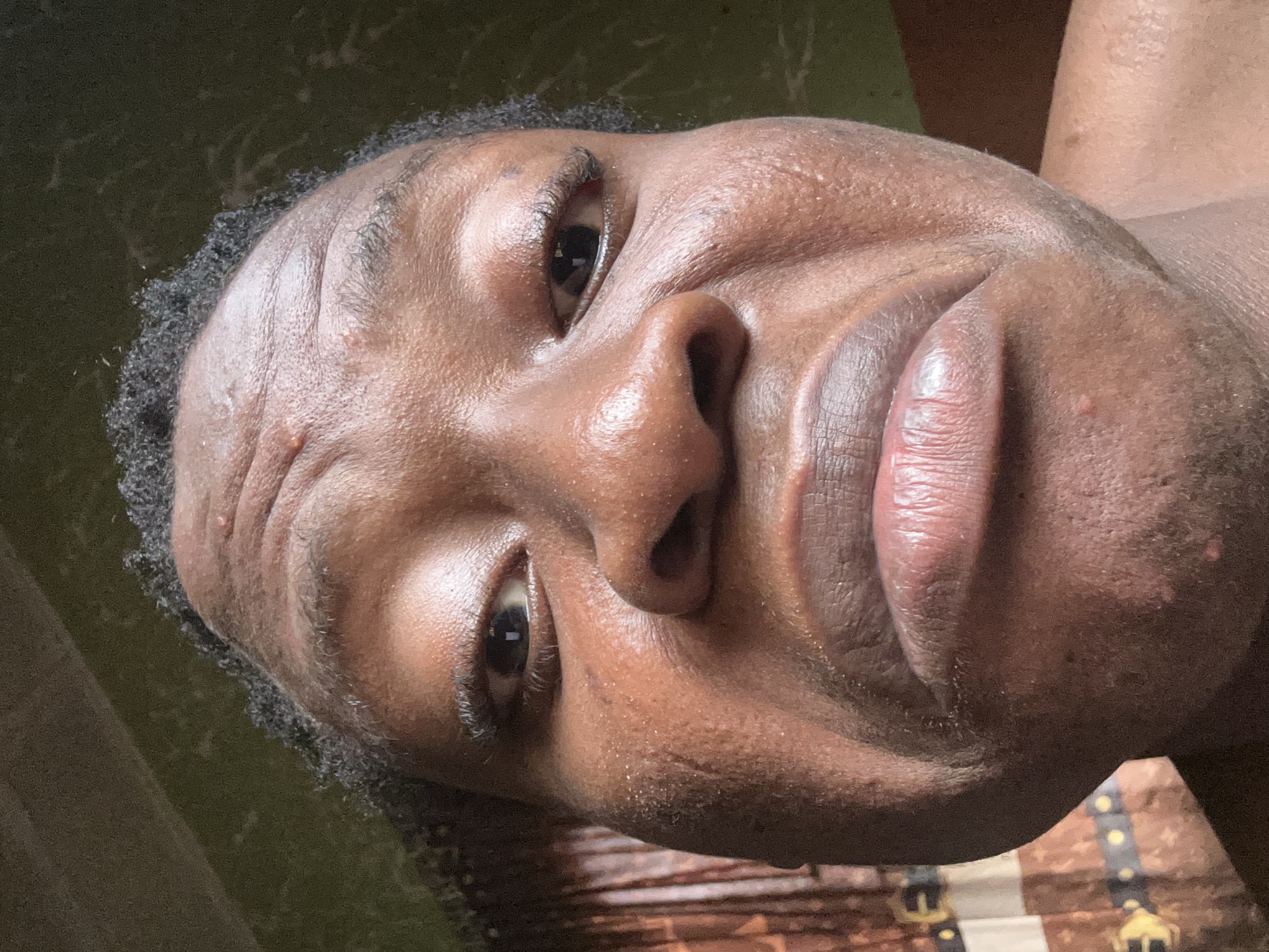 A close-up, slightly angled portrait of a person with dark skin, dark eyes, and short dark hair. The individual has a prominent nose and full lips. Skin appears to have a slightly oily sheen. The background is indistinct, with a mix of muted green and brown colors. A piece of clothing with a brown and gold pattern is visible in the lower right corner. The location is unknown.