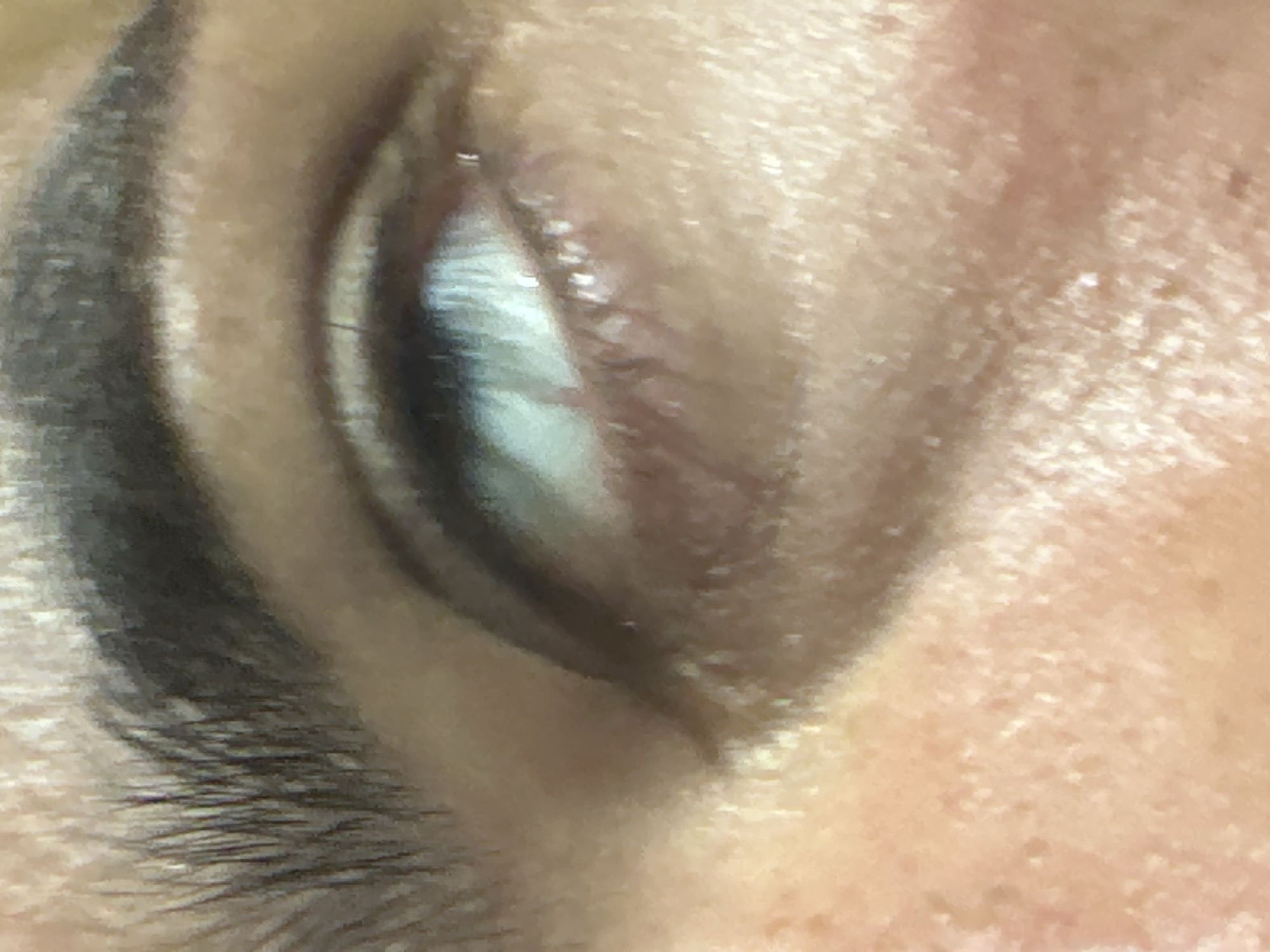 The image is a close-up, high-angle shot of a person's eye, showing the eyebrow, eyelid, and sclera of the eye. The skin appears to have a textured surface with some small blemishes. The eyebrow is dark and well-defined. The sclera of the eye is visible, with a bright reflection on its surface. The image does not provide any information about the location in the city of El Masnou, Spain, or any specific context regarding people, subjects, objects, actions, or interactions.