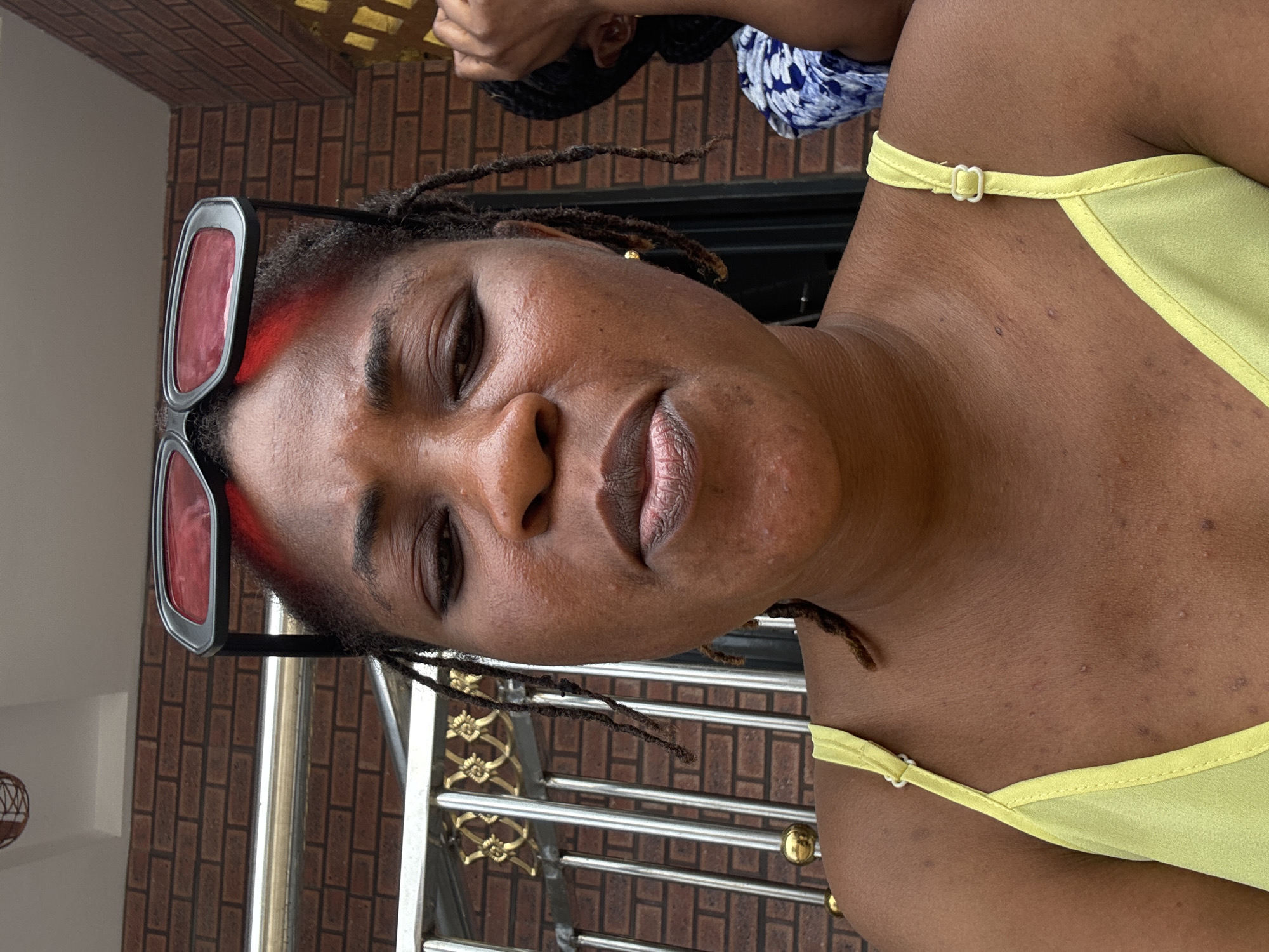 A close-up, medium shot captures a woman in the foreground with her sunglasses perched on her head. She is looking downwards, her mouth slightly open, with dry lips. Her skin shows some texture and minor blemishes. She is wearing a light yellow tank top with thin straps. Her dreadlocks are partially visible, with some strands falling around her face and shoulders. Behind her, a brick wall forms the backdrop, with a metal railing adorned with gold-colored decorative elements. To the right of the main subject, another person's arm and shoulder are visible, wearing a blue and white patterned garment. The overall setting appears to be outdoors, possibly a residential area, and it is implied to be in Ajara, Nigeria.