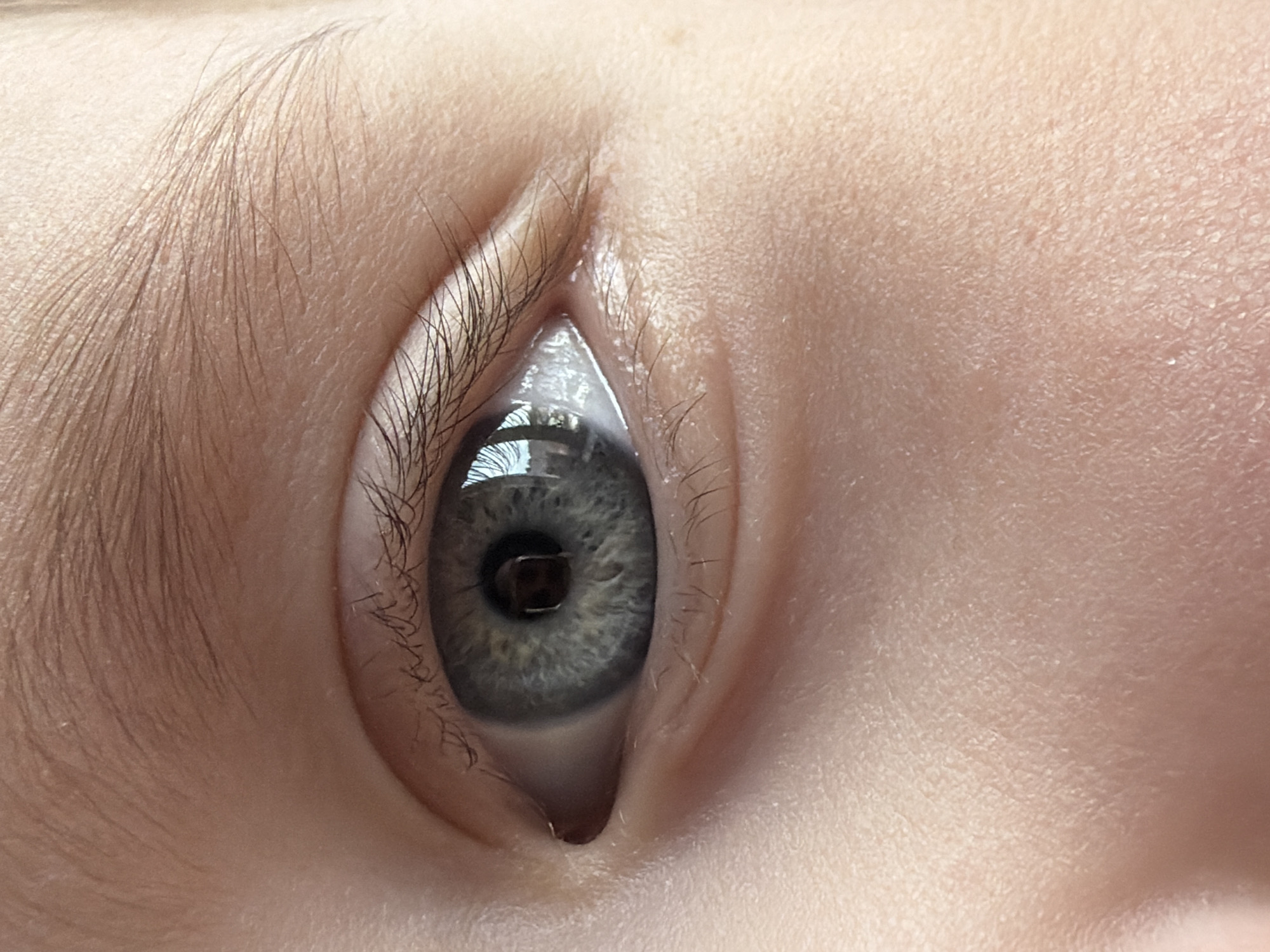A close-up, detailed photograph captures a human eye with gray iris, surrounded by a pale skin tone. The eye is slightly opened. The environment suggests it may be an indoor setting. There is no definitive way to associate this image with the city of Chaikovsky, Russia, or any specific location without further evidence. No people other than what is implied in the photo are visible.