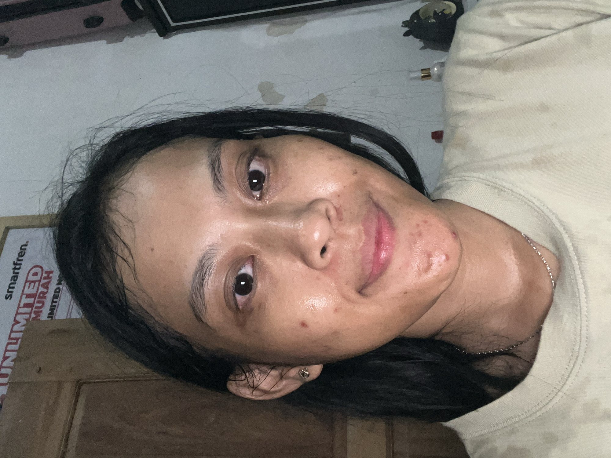 A close-up, front-facing photograph shows a young woman's face and upper chest. She has long, dark hair that frames her face. Her skin appears to have some redness and blemishes. She is wearing a light-colored, crew-neck shirt that is visibly stained in several places. Her expression is neutral, with her lips slightly parted. The background is out of focus, but hints of a wall and furniture can be seen. The lighting is dim, creating shadows on her face and body. The presence of a poster with text in Indonesian, including "smartfren" and "MURAH," suggests the location may be in Indonesia. While the specific location within Kecamatan Pati, Indonesia cannot be definitively determined from the image alone, it appears to be an indoor setting, possibly a home.