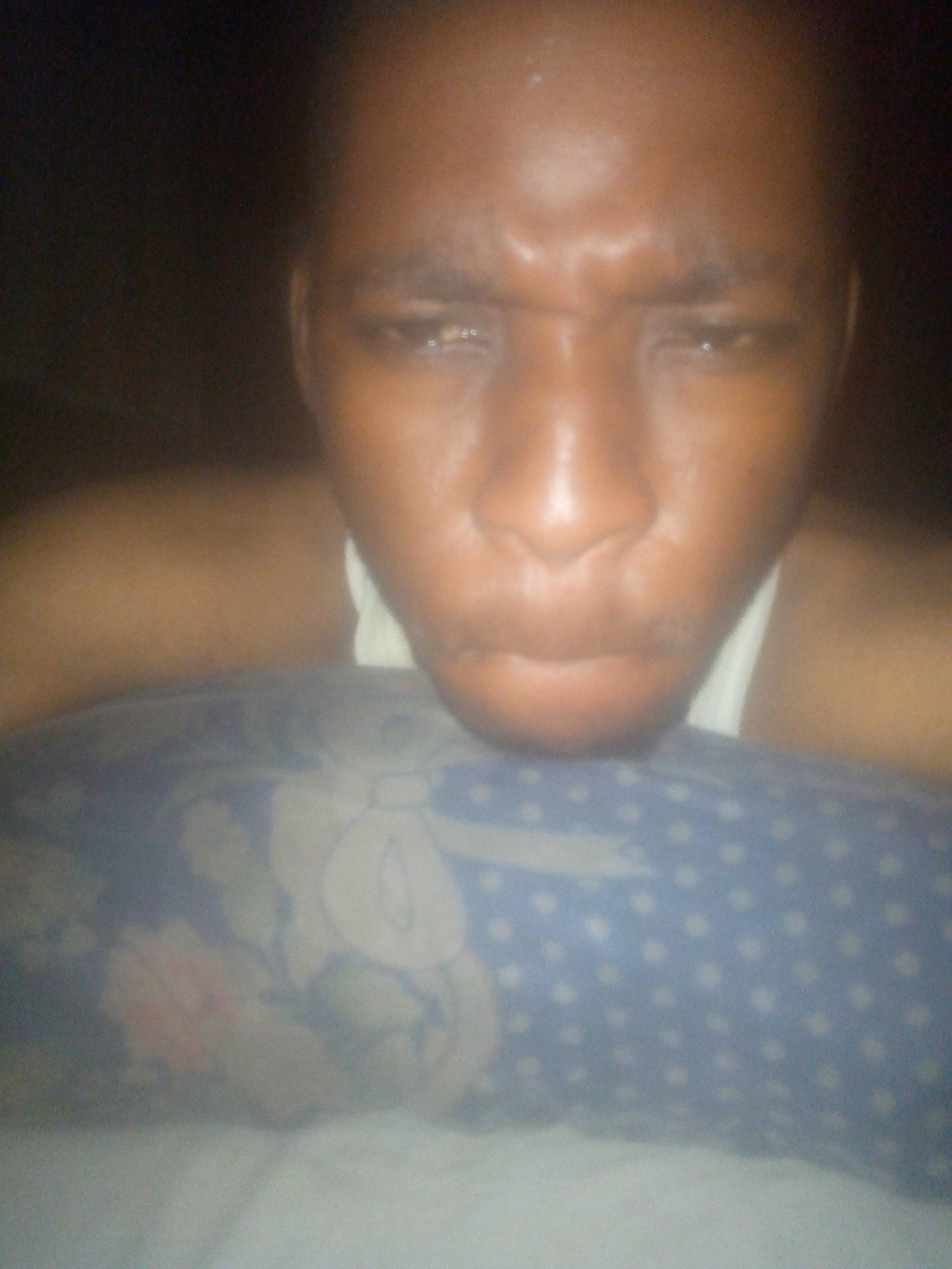 This media file captures a close-up portrait of a young adult male with dark skin, shown from the chest up. He is resting his head on a blue pillow that features both floral patterns and white polka dots. His facial expression is notable, characterized by furrowed eyebrows and a downturned mouth, conveying a sense of being pensive, tired, frustrated, or mildly distressed. His eyes are open but appear heavy-lidded. There is a distinct sheen on his forehead, nose, and upper lip, possibly from sweat or oil. A white strap, likely part of a tank top or similar garment, is visible near his neck and shoulder.
The setting appears to be indoors, most likely a bedroom, given the presence of the pillow and the relaxed pose. The background is dark and indistinct, indicating dim lighting conditions, suggesting the photo was taken at night or in a poorly lit room. The overall lighting is low, contributing to the intimate and somewhat somber mood of the image. No text is visible in the image.