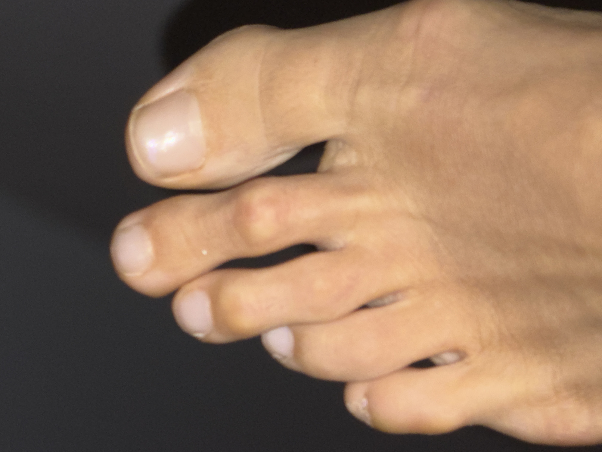 A close-up image shows the toes of a human foot. The skin tone is light, and the nails are natural and unpolished. There is no context to indicate a specific location, and there is no discernible connection to the city of Saint Petersburg, Russia.