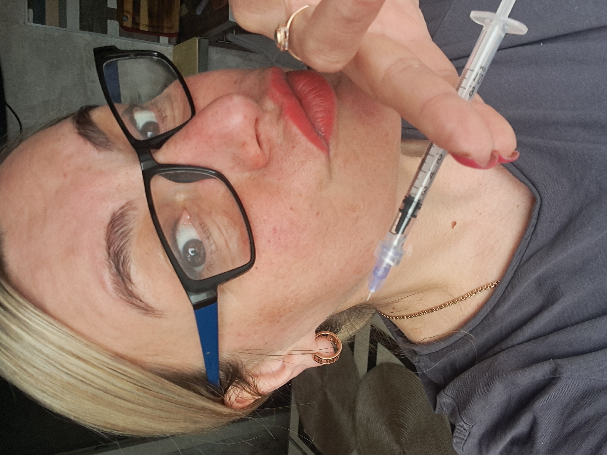 A person is undergoing an injection near the jawline, holding a syringe. They are wearing glasses, a gold ring, earrings, and a gold chain. The background is blurry, but suggests an indoor setting. The location is unknown.