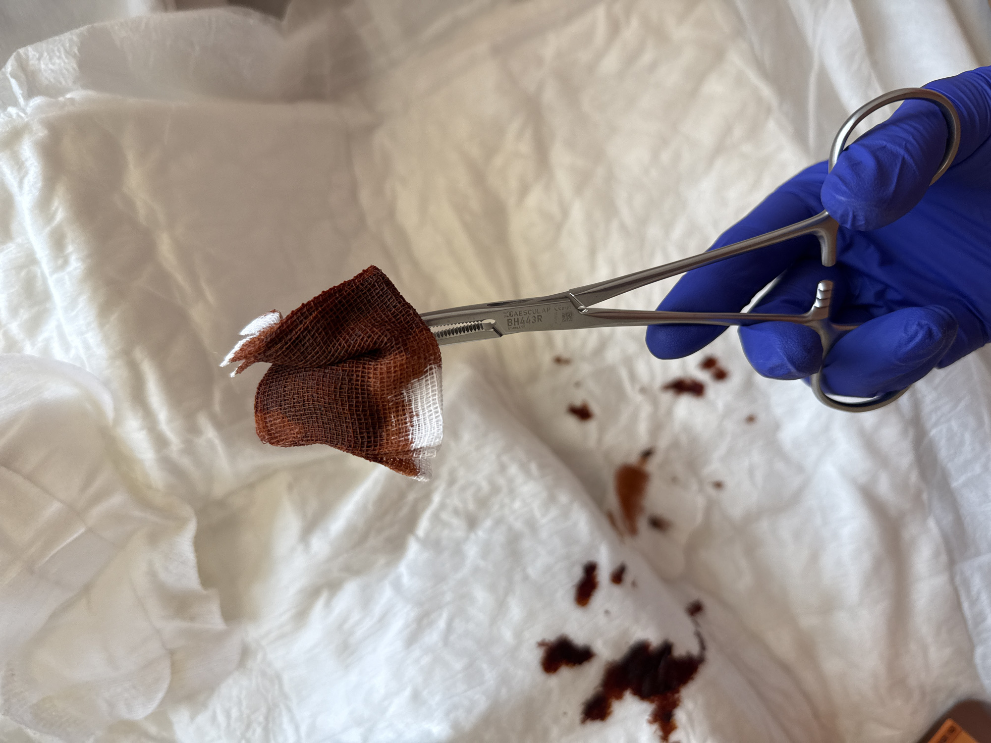 A gloved hand holds a surgical clamp gripping a bloodied gauze pad. The scene is set against a white background, with spatters of blood nearby. No information is available about the city of Pleven, Bulgaria from the image.