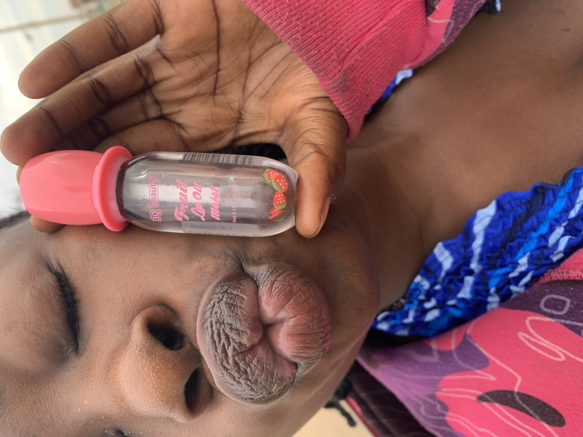 The image depicts a close-up of an individual with dark skin, situated outdoors in Rafin Par, Nigeria. The person's eyes are closed, and their lips are pursed into a prominent pout, exhibiting detailed skin texture. The individual's left hand (viewer's right) holds a small, clear cylindrical bottle featuring a bright pink, bulbous cap. The bottle's label, printed in pink, reads '3Q beauty® Fruit Lip Oil Moist', with the volume specified as 'Net: 0.17 fl.oz / 5ml'. Within the bottle, multiple small, red and green strawberry-shaped decorative pieces are visible. The person is wearing a patterned garment, predominantly pink and purple, over a blue and white patterned undergarment. The pink sleeve on the forearm holding the bottle displays dark smudges. The background is unfocused, suggesting an outdoor setting with an overcast sky or bright diffuse light, and indistinct distant structures.