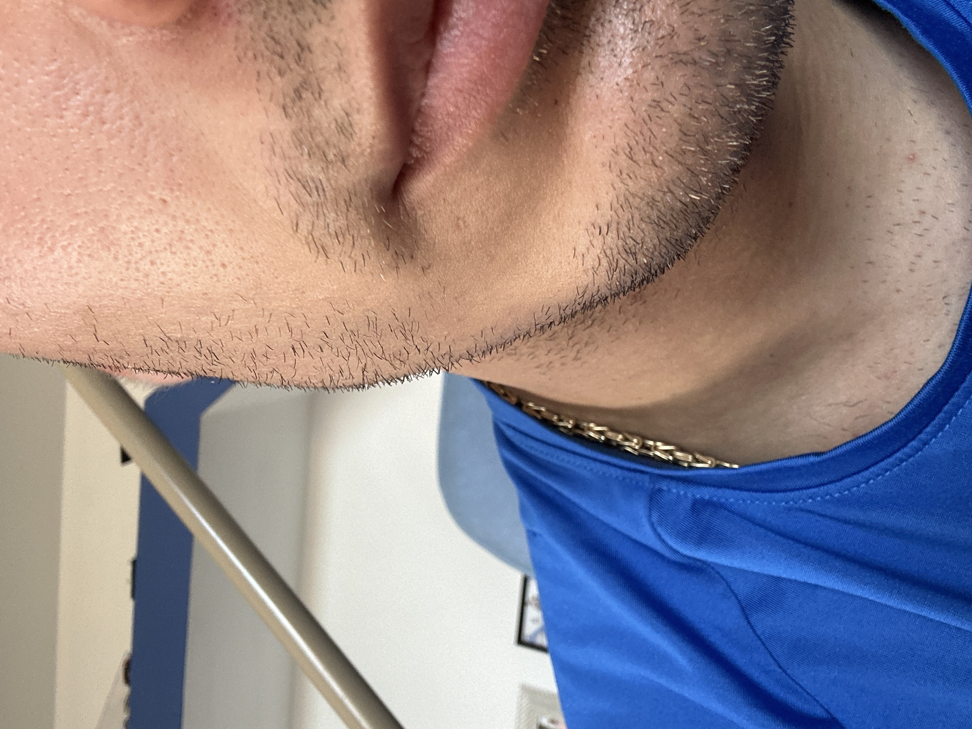 The image shows a close-up view of a person's lower face and neck. The person has a short, dark beard. They are wearing a blue t-shirt and a gold chain. The background is out of focus but appears to be an interior setting with a white wall and a metal pole. The location is Unknown, Unknown.