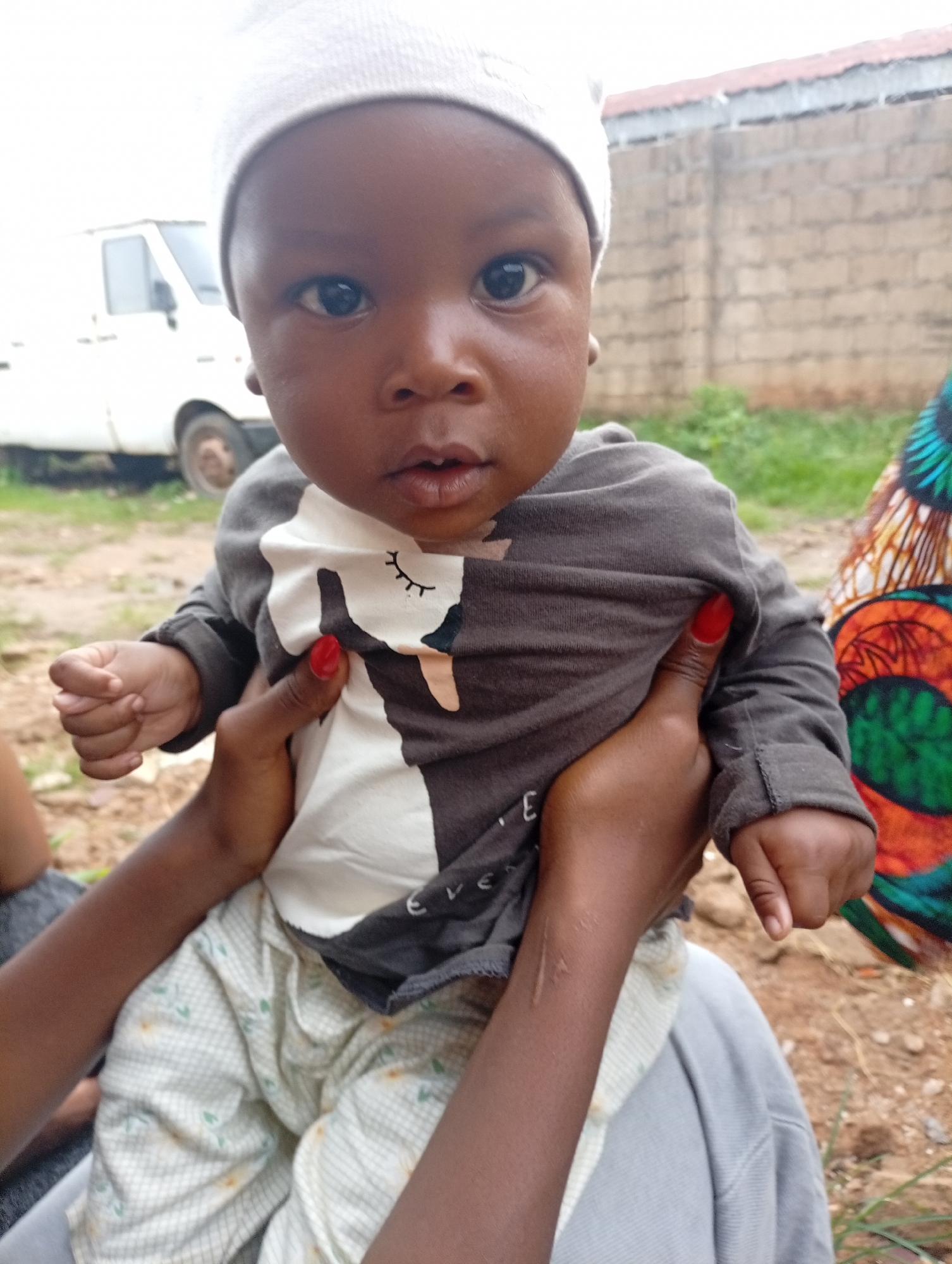 A medium frontal shot captures an infant held by an adult in an outdoor setting in Sabon Tasha, Nigeria. The infant, wearing a white beanie, a long-sleeved grey and white shirt featuring a stylized animal print, and light-colored patterned trousers, looks directly at the viewer. The infant is supported by two dark-skinned hands, one with red nail polish on the thumb and index finger, and a visible scar on the inner forearm of the left arm. The infant appears to be sitting on the lap of this individual, whose lower body is clad in light grey fabric.
The background consists of a blurred outdoor environment. To the left, a white van is partially visible, parked on an unpaved, reddish-brown dirt surface. The sky above the van is bright. To the right, a light-colored concrete block wall with a reddish-brown roof structure is visible, with green vegetation growing at its base. A section of vibrantly colored fabric, possibly belonging to another person's attire, displaying geometric patterns in shades of orange, green, and blue, is visible on the far right. The ground throughout the scene is primarily reddish-brown dirt with sparse green plant growth.