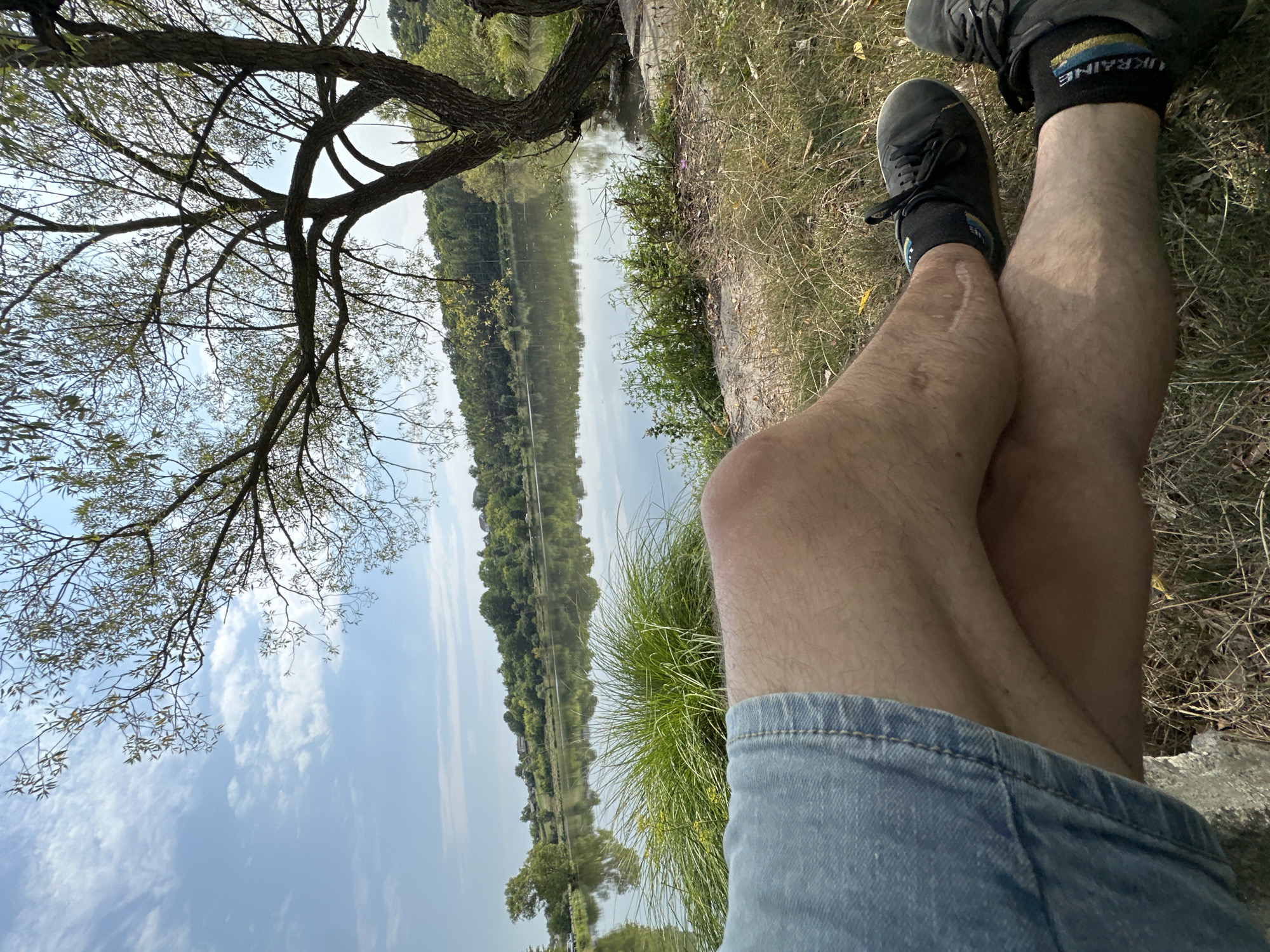 The image depicts a low-angle view of a person's legs and feet resting on a grassy embankment next to a calm body of water. The person is wearing denim shorts and dark sneakers with socks that have the Ukrainian flag colors and the word "UKRAINE" printed on them. The legs show visible scars. A large tree with thin branches and leaves is prominent in the foreground and branches out into the upper part of the frame, casting shadows. The water reflects the sky and the surrounding lush green trees and foliage on the opposite bank, which also shows a cluster of houses. The sky is blue with scattered white clouds. The overall setting suggests an outdoor recreational area, likely a park or lakeside, in or near Makiv, Ukraine.