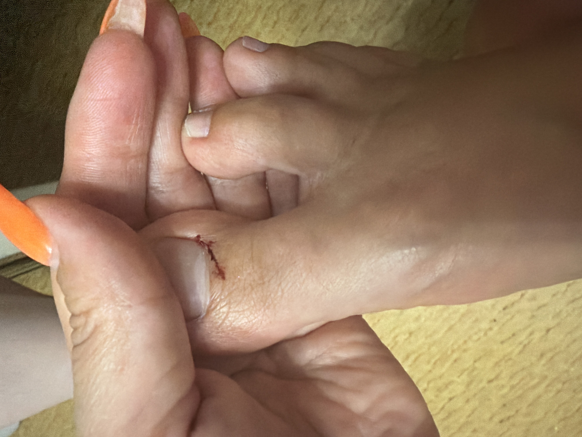The image shows a close-up view of a person's foot with a cut on the toe. The foot is positioned on a wooden surface. The cut appears to be recent and shows some redness. The person's fingers, with orange nail polish, are holding the foot. The location in Sochi, Russia, is not discernible from the image.