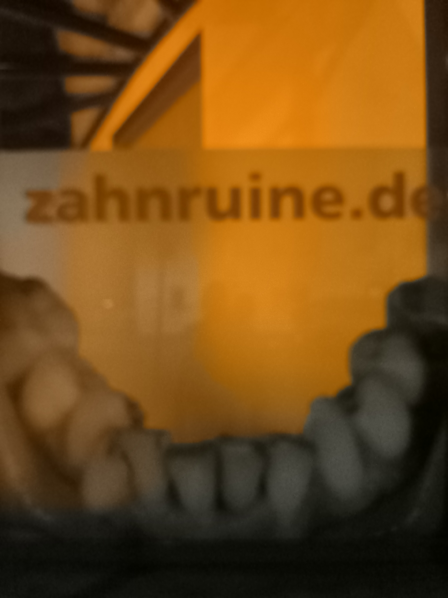 The image shows a close-up, out-of-focus view of a dental x-ray of a human jaw with teeth, superimposed over a yellow and orange background with text that reads "zahnruine.de". The yellow and orange area appears to be a sign or display. The lower portion of the image is dark and blurry.