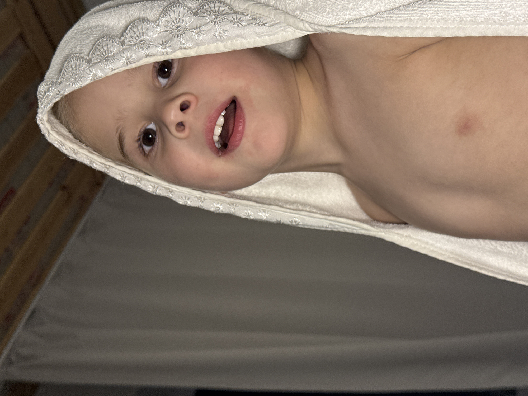 A young child with fair skin is partially visible, wrapped in a white towel with a decorative edge. The child's head is tilted, and they are looking up with an open mouth, revealing some teeth. The child's upper body is visible down to the chest, with a slight discoloration or mark present on the skin. The background includes a beige or off-white surface, possibly a bed or sheet, and a wooden structure that appears to be part of a bed frame or wall. No specific indicators suggest this image was taken in Chaikovsky, Russia; therefore, location information is not determinable.