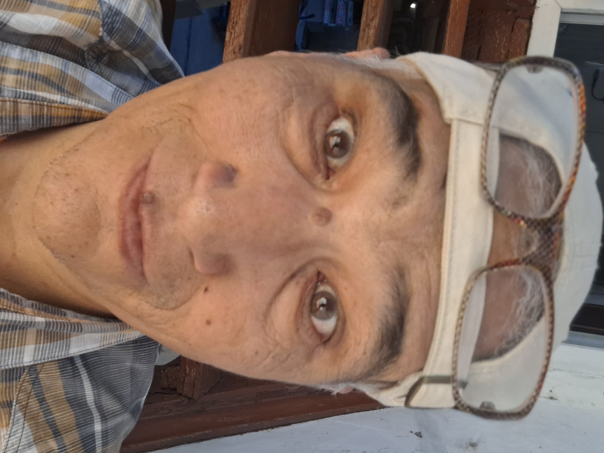 A close-up, low-angle, selfie-style shot shows a man wearing a white baseball cap and glasses. The man has fair skin, a mole on his nose, and what appears to be a birthmark or dark spot below his right eye. His eyes are wide open and looking directly at the camera. He is wearing a plaid shirt with brown, white, and gray stripes. The background shows wooden stairs and a white wall. The image is not set in Almaty, Kazakhstan.