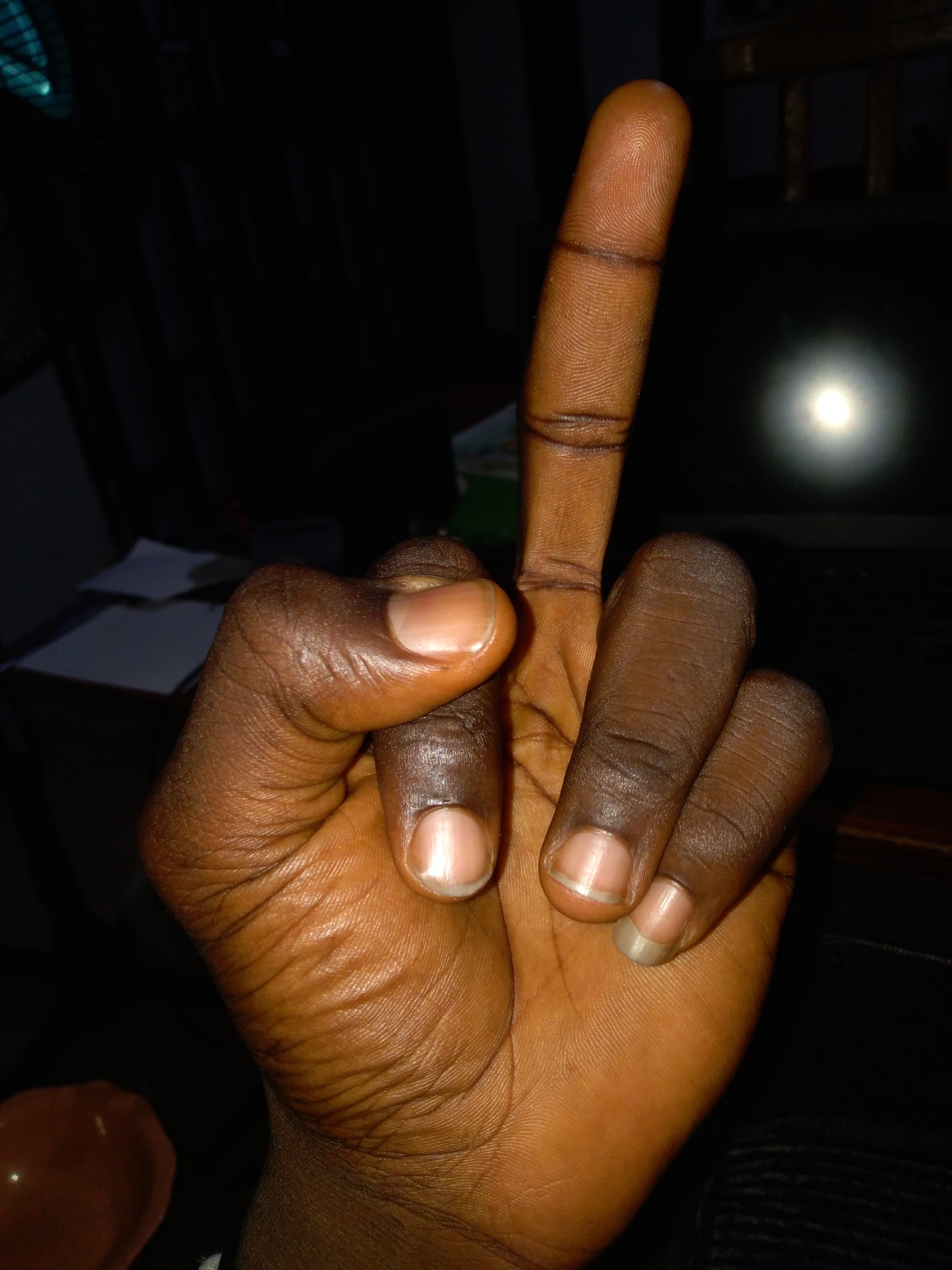 A close-up, low-light, eye-level shot shows a dark-skinned hand raised with the index finger extended upwards. The index finger has two dark lines circling it. The thumb is bent downwards, and the other fingers are curled into the palm. The background is dark and out of focus, with a bright, circular light source visible in the upper right quadrant. There are some objects in the background that appear to be papers and possibly a laptop. The image appears to have been taken indoors.