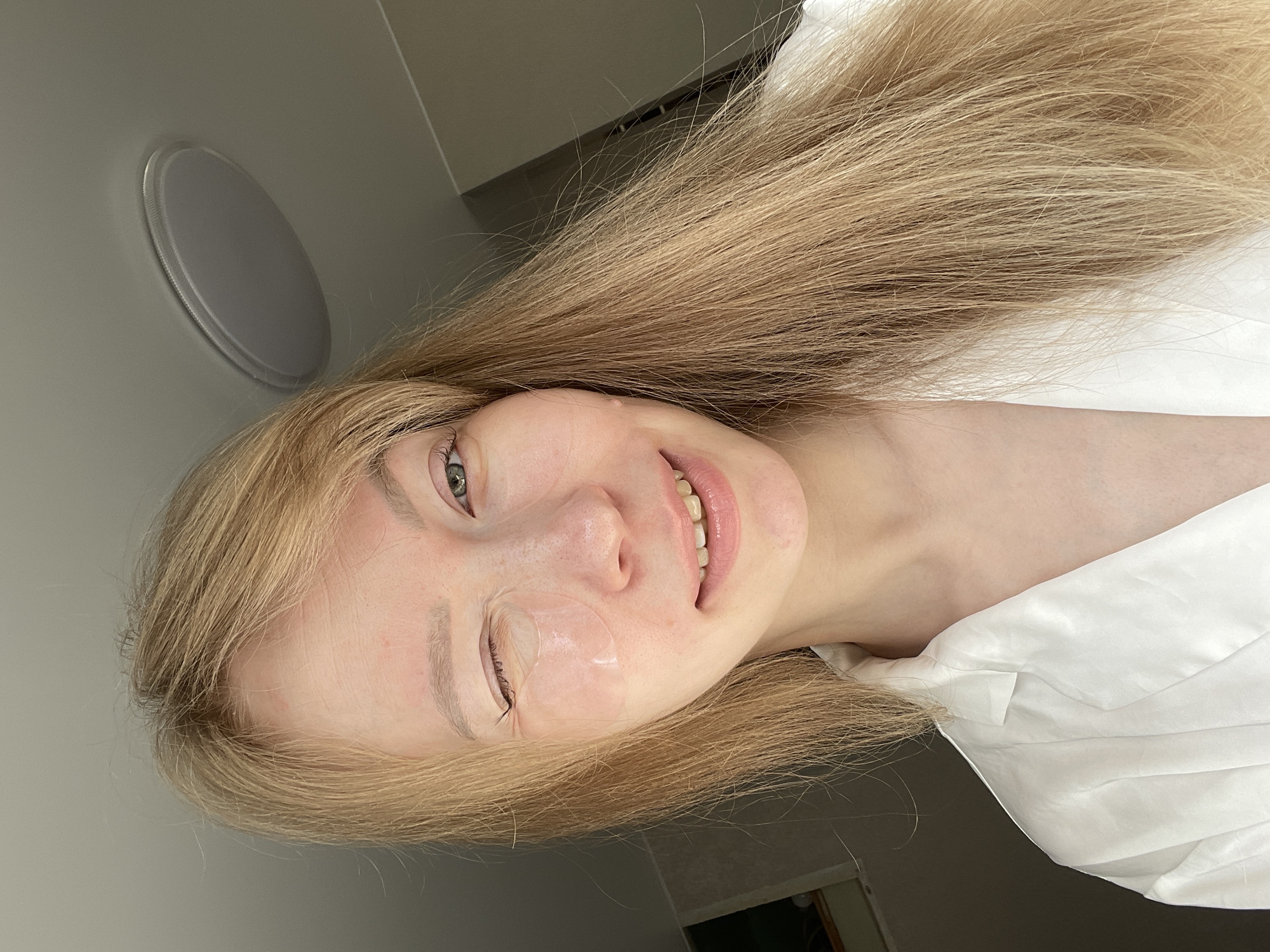 A fair-skinned woman with long, blonde hair smiles at the camera. She is wearing a white garment, possibly a shirt or robe. A translucent patch covers her left eye. The background features a gray wall and a circular ceiling light fixture. The location is not discernible from the image.