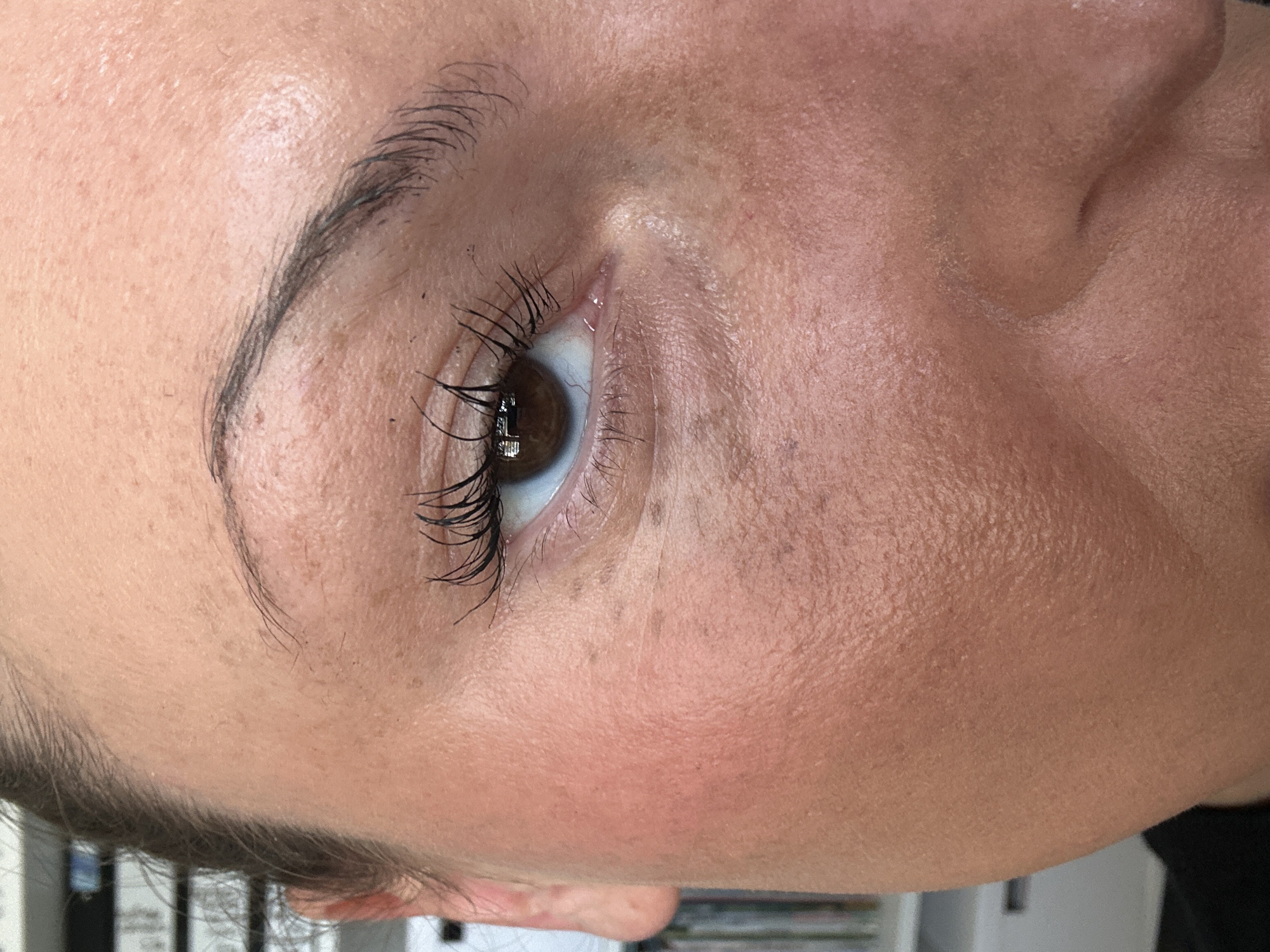 This is a close-up, angled photograph focusing on a person's right eye and the surrounding facial skin. The subject has fair to medium-toned skin, showing visible texture, pores, and a scattering of small freckles or dark spots on the forehead and cheekbone area. A well-defined, dark eyebrow arches above the eye.
The eye itself has a brown iris, with a noticeable reflection in the pupil, suggesting a light source like a window. Long, dark, and curled eyelashes frame both the upper and lower eyelids, indicating the application of mascara or possibly eyelash extensions. There are also smaller, finer hairs visible on the skin around the eye and near the hairline. The skin directly around the eye and on the upper cheek appears smooth but with fine lines consistent with natural skin texture.
The background is completely blurred and out of focus, suggesting an indoor setting with indistinct shapes that could be furniture or shelving. The image is composed to highlight the detail of the eye and its enhancements. There is no discernible specific activity, other than posing for this detailed shot, possibly showcasing a beauty treatment. No explicit emotions are conveyed, and no text is visible. The external context for this image is Tunbridge Wells, United Kingdom.