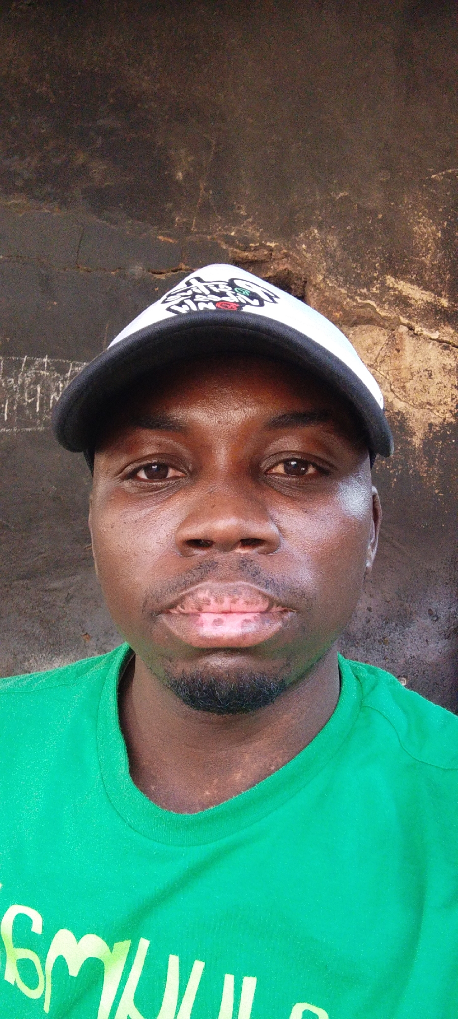 A close-up portrait features a Black man from the shoulders up, looking directly at the camera with a neutral expression. He appears to be young to middle-aged, with dark skin, brown eyes, and a small goatee on his chin.
He is wearing a white baseball cap with a black brim. A multi-colored logo and inverted stylized text, possibly "WORLD" or similar, are visible on the front of the cap. He also wears a bright green crew-neck t-shirt; the lower edge of some light-colored, stylized text is faintly visible on the shirt, but is unreadable.
Notable details include patches of lighter pigmentation on his lips, particularly on the upper lip and the center of the lower lip. A few small, lighter spots are also visible on his neck above the t-shirt collar.
The background is a dark, textured surface, possibly a wall or rock, displaying varying tones of brown and some cracks or uneven patterns. On the left side, behind his head, there are some faint white markings or possibly old graffiti. The lighting appears to be natural daylight, evenly illuminating the subject. The overall setting is casual, likely outdoors in Jos, Nigeria.