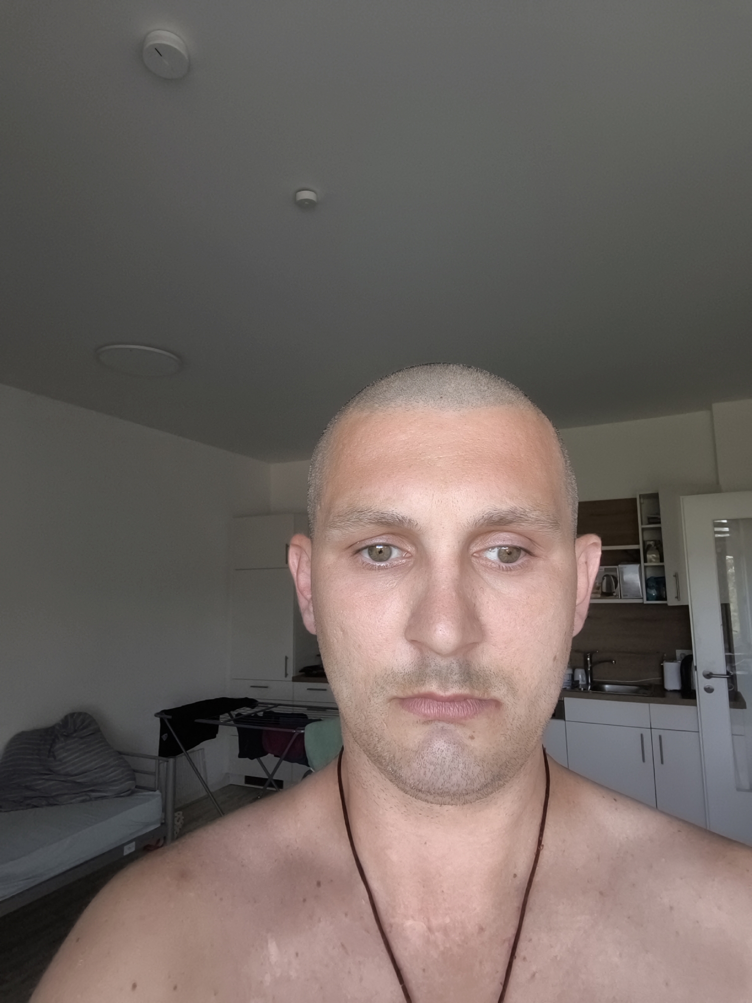 A man with a shaved head is captured in a medium close-up, facing the camera directly. He has light skin with some areas of discoloration on his shoulders and upper chest, as well as a few moles. His eyes are a light brown, and he has a neutral expression. A dark cord necklace rests against his bare chest and neck. The background suggests an indoor setting, possibly an apartment. To the left, a bed with striped bedding is visible, along with a drying rack holding laundry. To the right, a kitchen area is partially seen, featuring white cabinets, a sink with a faucet, and a stovetop. The lighting is bright, with a ceiling fixture and natural light coming from a window, casting subtle shadows. The overall impression is that of a candid snapshot taken in a domestic environment.