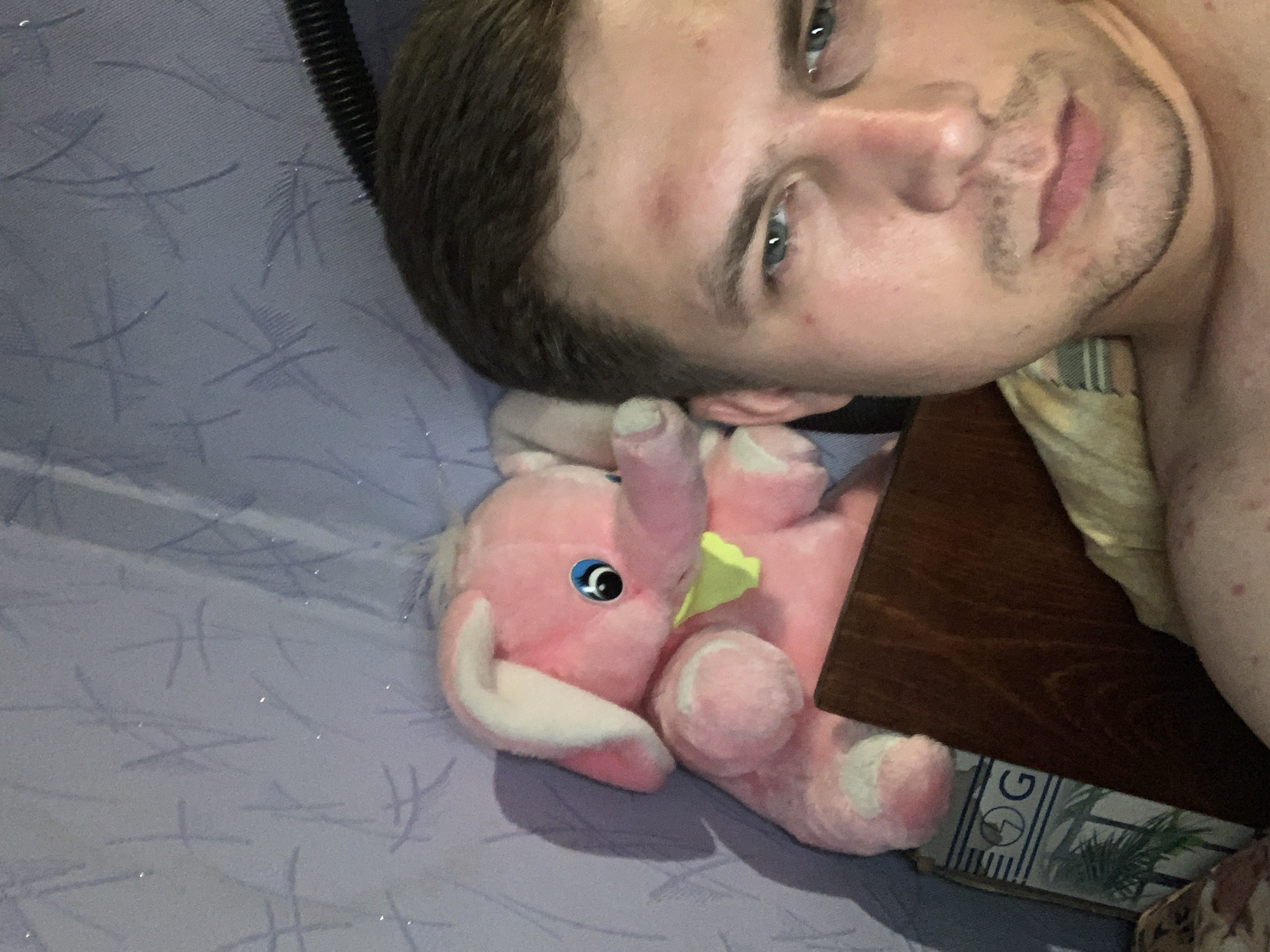 The image shows a close-up selfie of a young man with short brown hair and blue eyes. He is looking at the camera with a neutral expression. He has a small bruise on his forehead and some blemishes on his face. To his left, a pink stuffed elephant toy is visible, sitting next to a wooden object that appears to be part of a piece of furniture. The background is a textured wall with a pattern of thin, dark lines. The lighting is dim, and the overall atmosphere of the image is casual and personal. The location is not specified.
