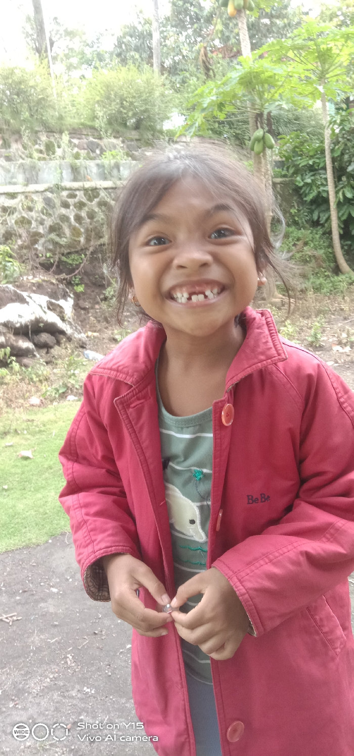 This image captures a young child, appearing to be female, smiling broadly while looking directly at the camera in Ranugedang, Indonesia. The child has dark hair and exhibits multiple missing deciduous teeth in both the upper and lower jaw. She is wearing a red collared jacket with the text "Be Be" embroidered on the left chest, over a light green striped t-shirt featuring a white dolphin graphic. Small golden hoop earrings are visible in each ear. Her hands are positioned at waist level, holding a small, shiny silver-colored object. The background consists of dense green tropical foliage, including papaya trees bearing green fruit on the right side. To the left, a weathered stone retaining wall with moss and small plants is visible, situated on a slope with dry grass and debris. The foreground features a dark grey asphalt or concrete surface. A "Shot on Y15 Vivo AI camera" watermark is present in the lower-left corner of the image.