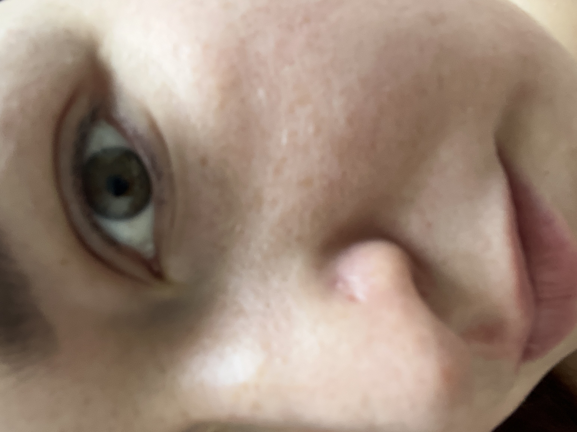 This is a close-up, slightly out-of-focus photograph of a person's face, primarily showing the right eye, nose, and mouth area. The subject has light skin with visible freckles and some slight redness on the cheek. The eye appears to be hazel. The lighting suggests an indoor environment, possibly with a flash. The image does not provide any information about the location within the city of Chelyabinsk, Russia, nor does it depict any interaction or specific action.