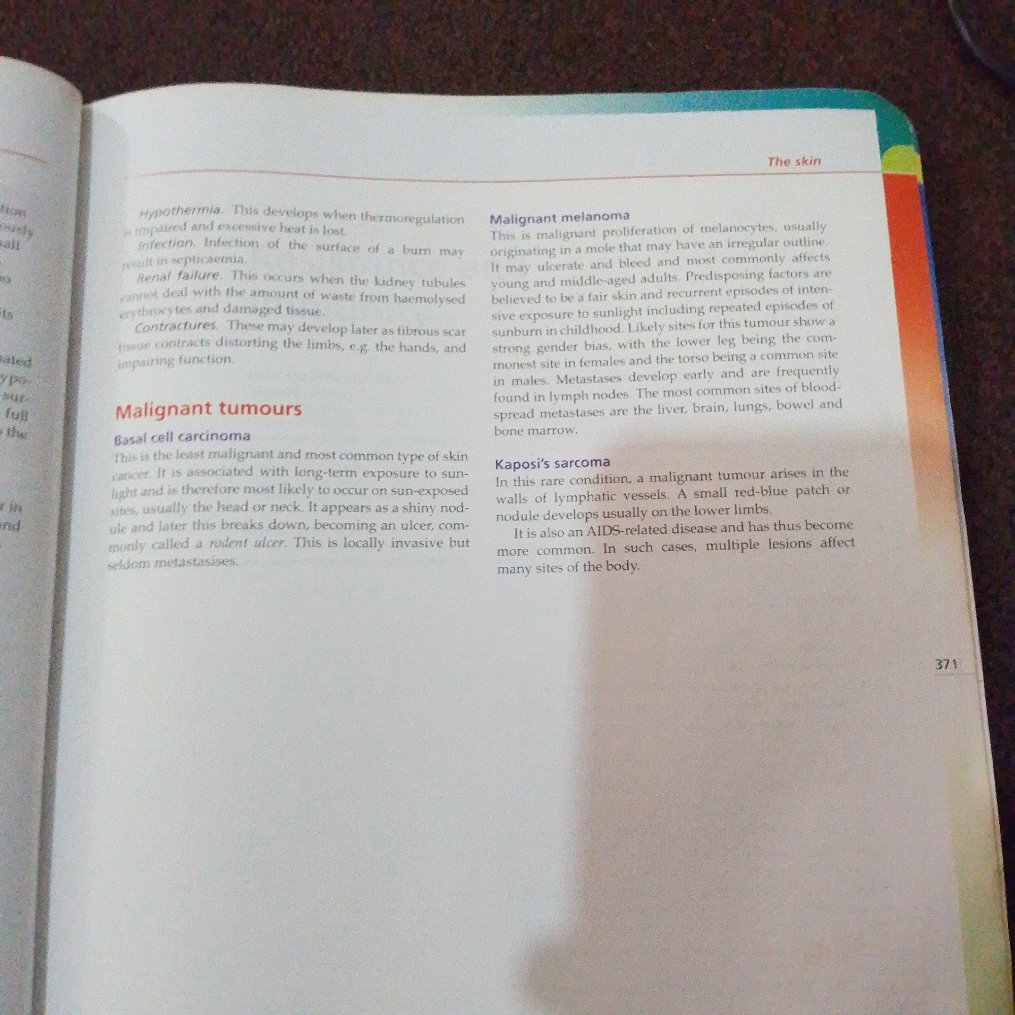 The image shows a book open to a page discussing skin conditions. The text covers topics such as hypothermia, renal failure, contractures, malignant melanoma, basal cell carcinoma, and Kaposi's sarcoma. The page number "371" is visible in the bottom right corner. The background is a dark, textured surface, possibly a table or carpet. There are no visible elements in the image that would suggest a location in Jalingo, Nigeria.