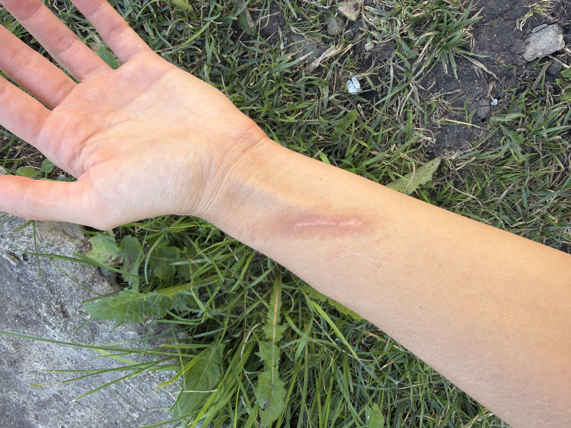 The image shows a close-up view of a person's forearm and hand resting on the ground in an outdoor environment with grass and some rocks. The forearm exhibits a scar on the wrist area. The hand is open, palm facing upwards. The background consists of green grass, dirt, and a portion of a gray, rough surface, possibly concrete. There is no indication of the location being the city of Петряксы, Russia, nor any specific action or interaction occurring.