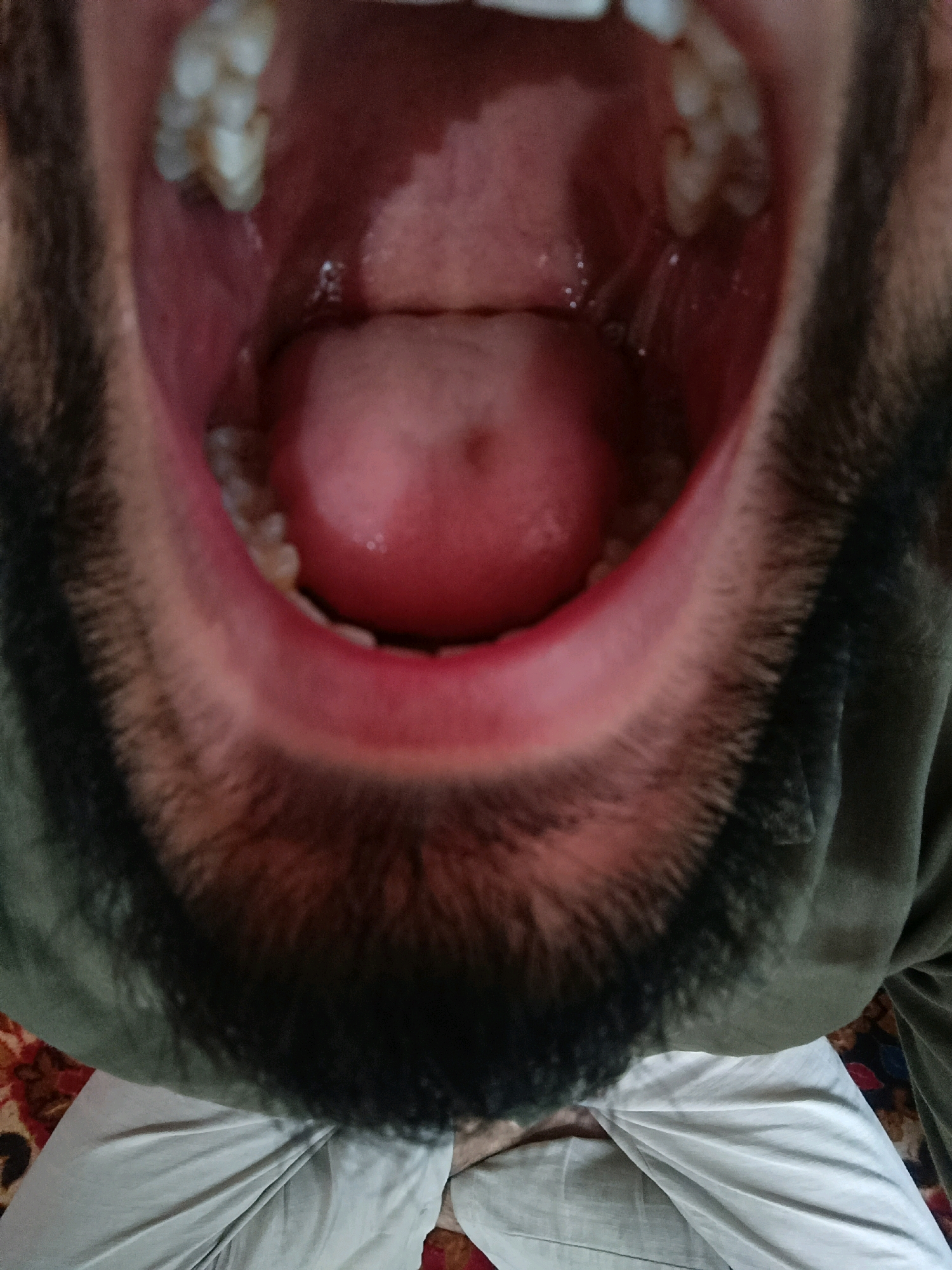 The image provides a close-up, low-angle view inside a person's open mouth. The person has dark facial hair, visible around the edges of the frame. The tongue is pink and occupies the central area of the mouth. Teeth are visible, some appearing slightly discolored. The inside of the mouth is moist. The background is blurred, but suggests clothing, likely pants, and a patterned rug. The image does not contain any elements that indicate a specific location within Srinagar, India.