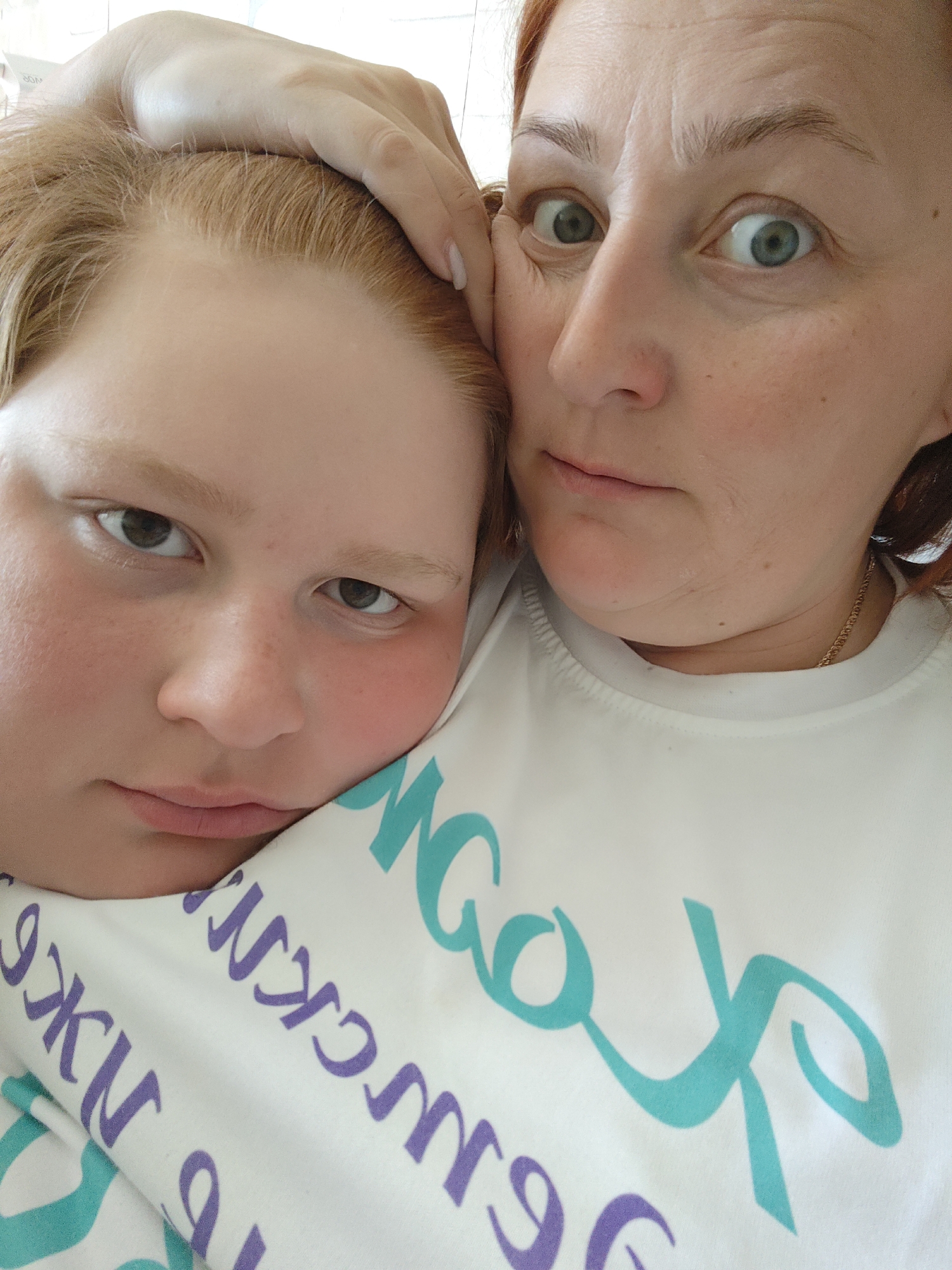 Two individuals are closely positioned in the image. On the left, a person with fair skin and light red hair rests their head on what appears to be a patterned white t-shirt. Their facial expression appears solemn or tired. To the right, a woman with reddish-brown hair, fair skin, and green eyes is looking directly at the camera. Her right hand touches the head of the person on the left. The t-shirt has teal and purple lettering; some of the visible letters appear Cyrillic. A thin gold chain is visible around the woman's neck. The scene appears to be indoors under bright lighting. There is no indication in the image that it is located in Фоки, Russia.